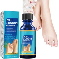 ضد قارچ کاشت ناخن ضد قارچ کاشت ناخن