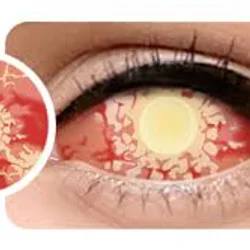 لنز فانتزی و نمایشی