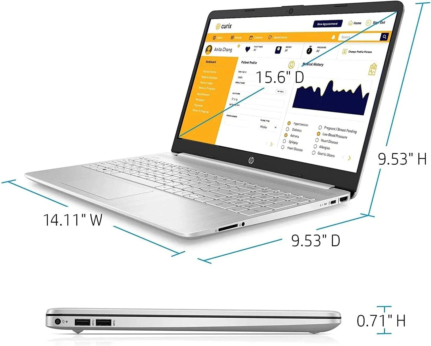 لپ تاپ اچ پی 15.6 اینچی HD با پردازنده Intel Core i3-1005G1 نسل دهم 3.4 گیگاهرتز، 8 گیگابایت رم، 256 گیگابایت SSD و ویندوز 10 لپ تاپ اچ پی 15.6 اینچی HD با پردازنده Intel Core i3-1005G1 نسل دهم 3.4 گیگاهرتز، 8 گیگابایت رم، 256 گیگابایت SSD و ویندوز 10