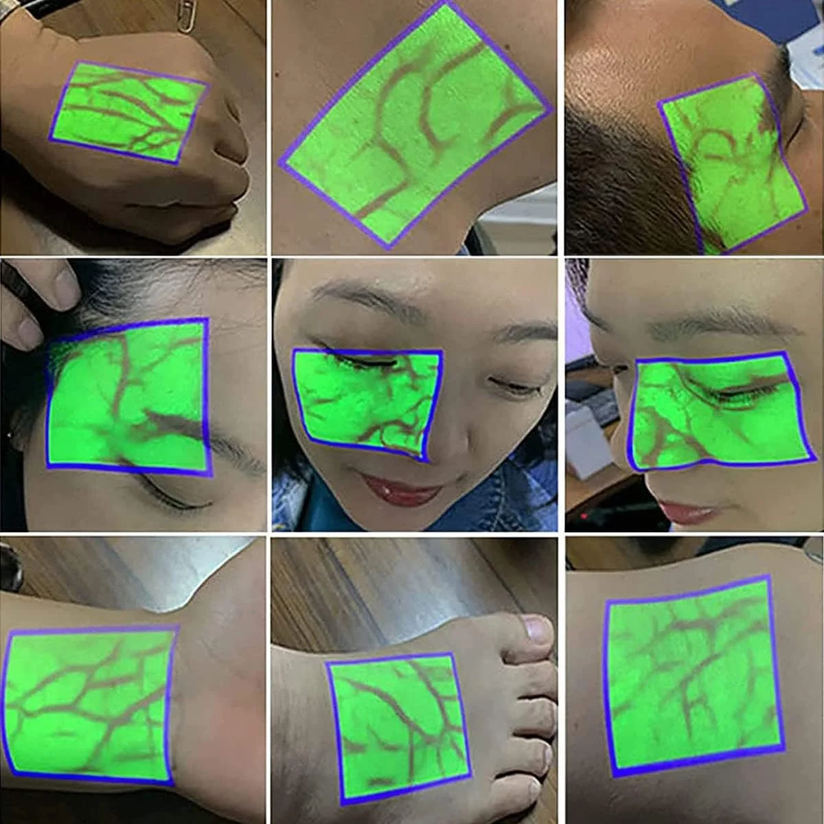 دستگاه رگ یاب قابل حمل REHOOF، تشخیص آسان محل رگ، مناسب برای تزریق وریدی، نمایشگر رگ، چراغ های روشنایی قابل حمل برای پرستاران، تصویربرداری از رگ ها برای فلبوتومی IV