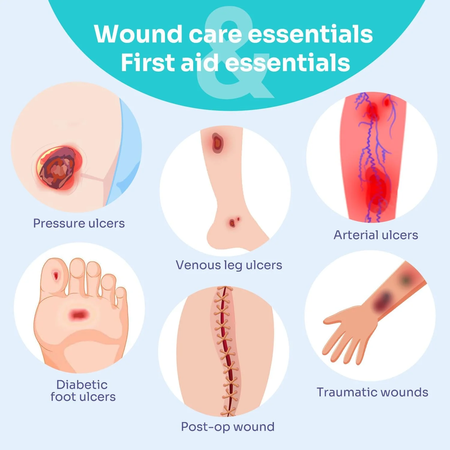 پانسمان سیلیکونی فوق جاذب زخم با حاشیه بسته 10 عددی، 5" X 5" واجد شرایط FSA HSA، بانداژهای چسبنده ملایم برای زخم های با ترشح زیاد، پدهای مراقبت از زخم نرم برای زخم، جراحی، سوختگی درجه l - ll پانسمان سیلیکونی فوق جاذب زخم با حاشیه بسته 10 عددی، 5" X 5" واجد شرایط FSA HSA، بانداژهای چسبنده ملایم برای زخم های با ترشح زیاد، پدهای مراقبت از زخم نرم برای زخم، جراحی، سوختگی درجه l - ll