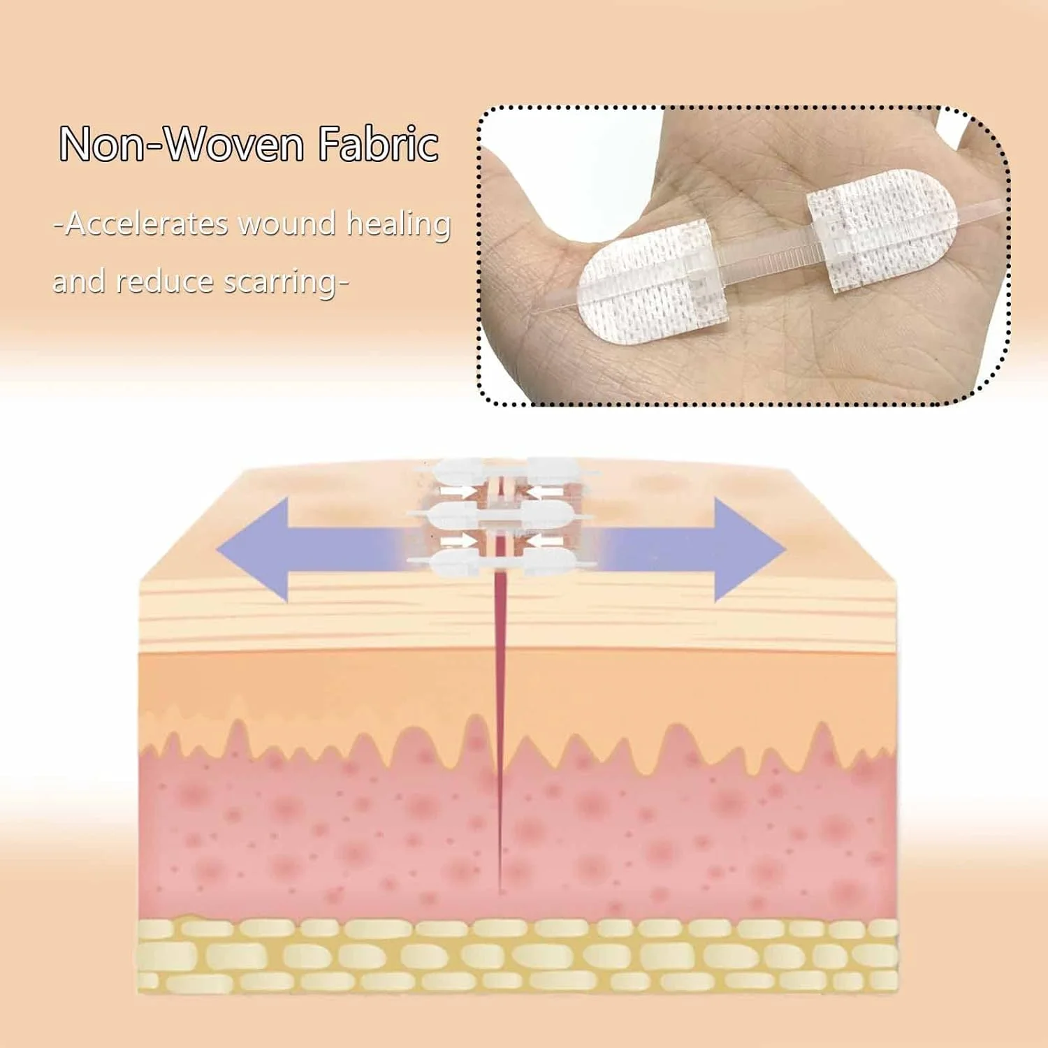 چسب بخیه جایگزین بخیه MENURSY برای مراقبت اضطراری از زخم، بستن زیپی زخم بدون نیاز به بخیه، چسب بخیه برای کمک های اولیه، سفید، 3 عدد (45 * 10 میلی متر) چسب بخیه جایگزین بخیه MENURSY برای مراقبت اضطراری از زخم، بستن زیپی زخم بدون نیاز به بخیه، چسب بخیه برای کمک های اولیه، سفید، 3 عدد (45 * 10 میلی متر)