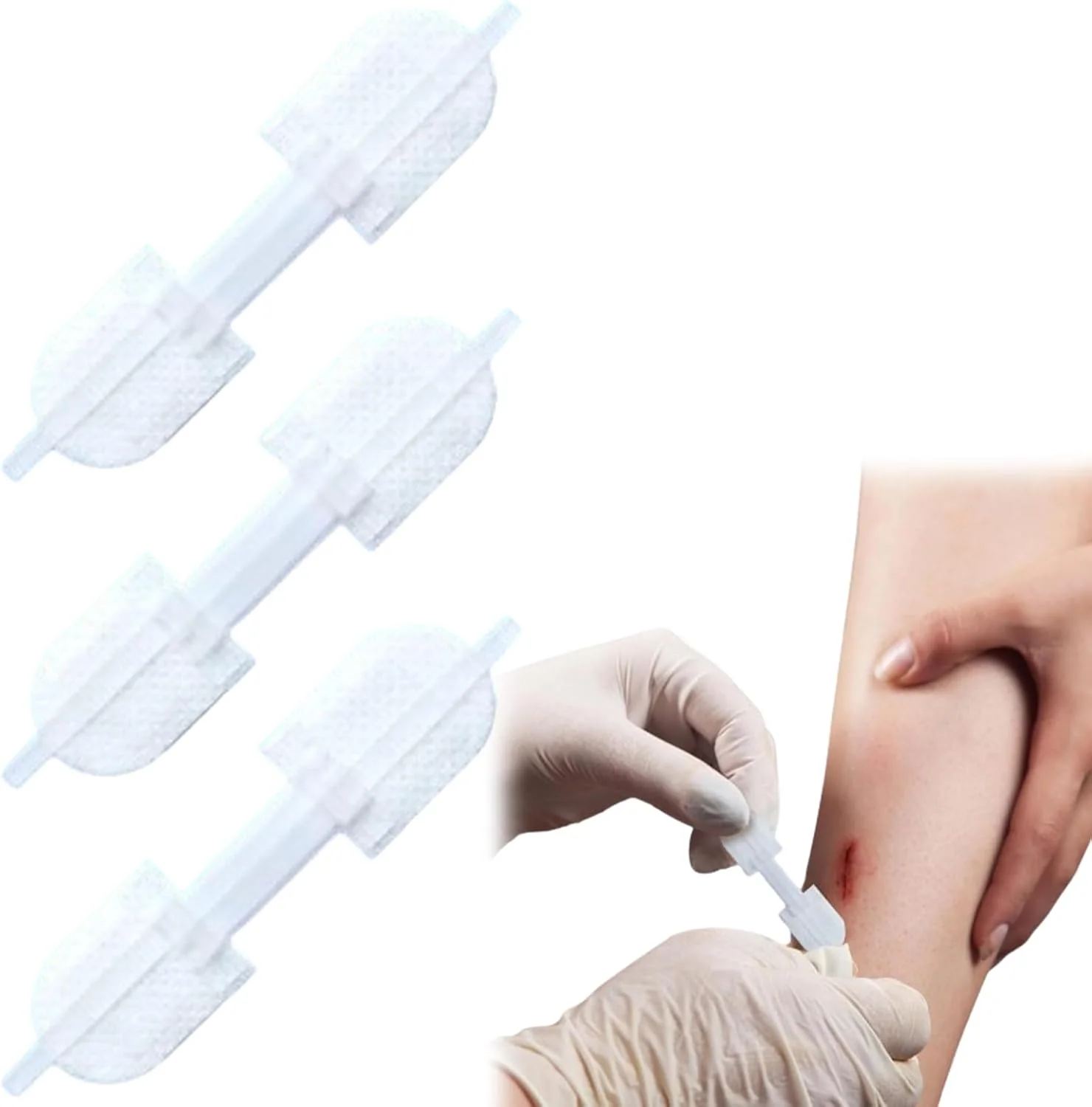 نوار بخیه بستن زخم نالاکال، کیت بستن اضطراری پارگی برای ترمیم زخم های ترکیبی بدون بخیه، چسب بخیه پروانه ای برای بستن زخم، پوشاندن زخم 3 عدد