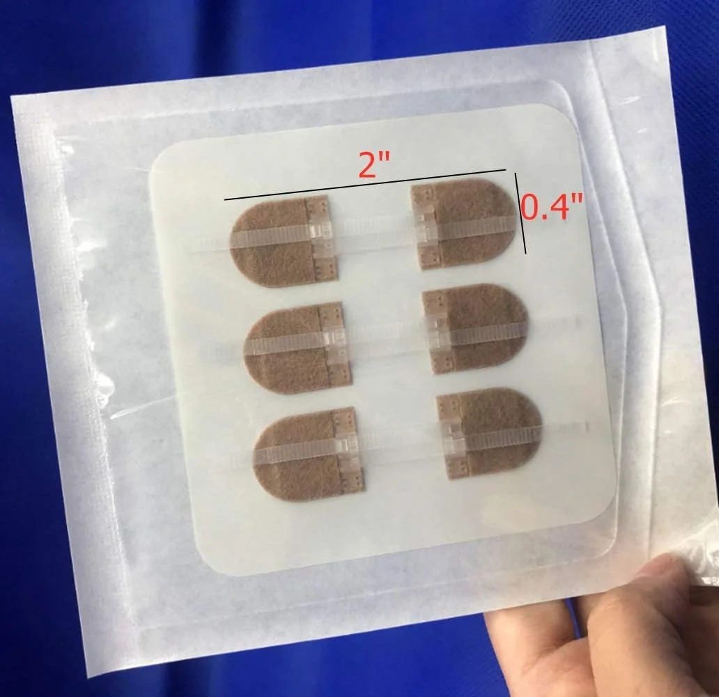 چسب بخیه اضطراری Mediss، استیکرهای بخیه زیپی برای کمپینگ، بقا و لوازم خانگی، 3 عدد (45 * 10 میلی متر، رنگ پوست)