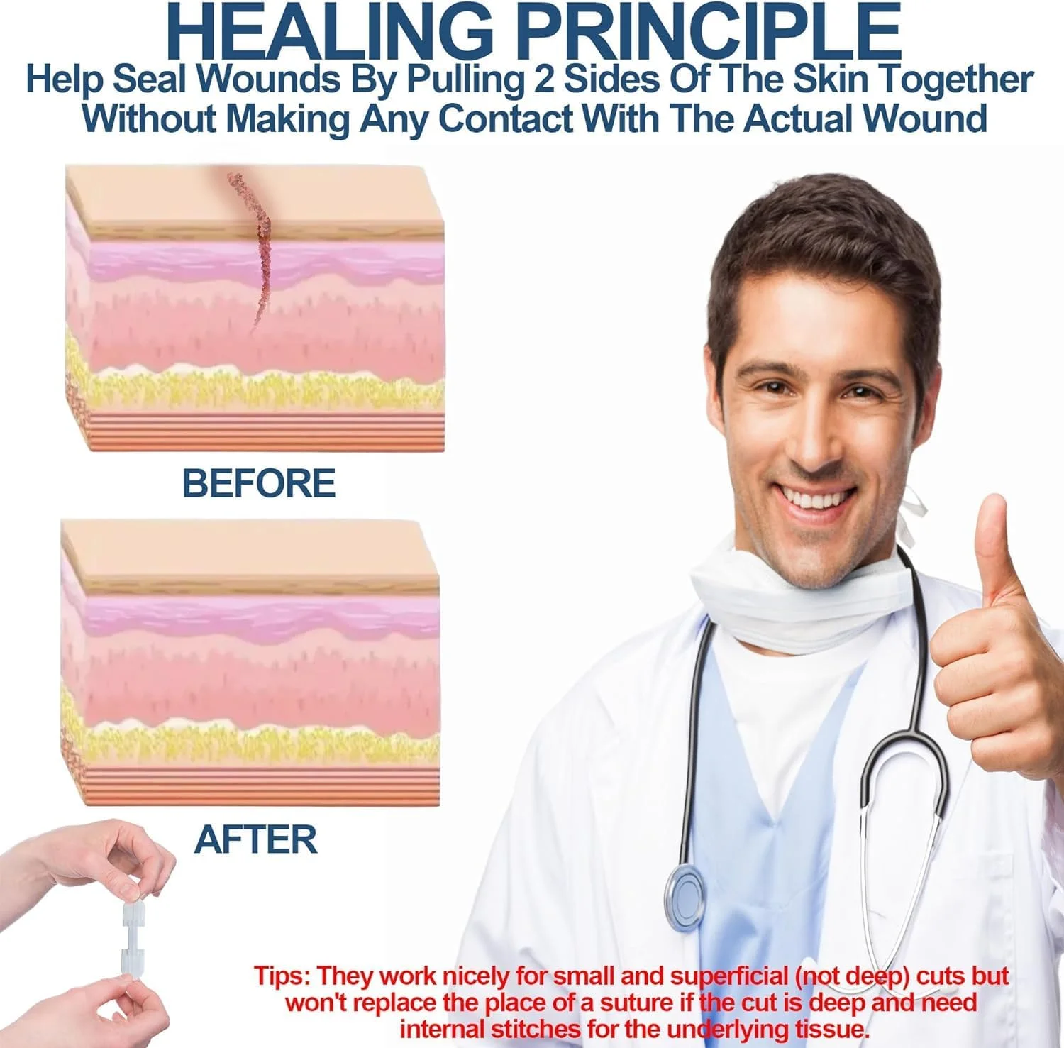 نوار بخیه بستن زخم نالاکال، کیت بستن اضطراری پارگی برای ترمیم زخم های ترکیبی بدون بخیه، چسب بخیه پروانه ای برای بستن زخم، پوشاندن زخم 3 عدد نوار بخیه بستن زخم نالاکال، کیت بستن اضطراری پارگی برای ترمیم زخم های ترکیبی بدون بخیه، چسب بخیه پروانه ای برای بستن زخم، پوشاندن زخم 3 عدد