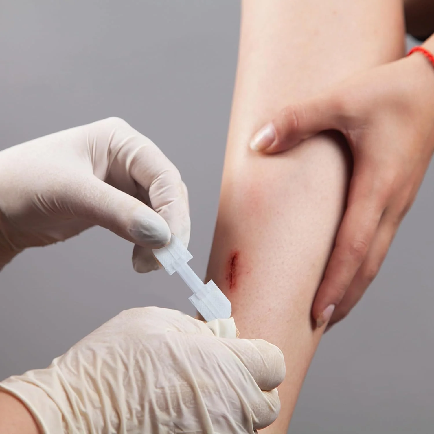 نوار بخیه بستن زخم نالاکال، کیت بستن اضطراری پارگی برای ترمیم زخم های ترکیبی بدون بخیه، چسب بخیه پروانه ای برای بستن زخم، پوشاندن زخم 3 عدد نوار بخیه بستن زخم نالاکال، کیت بستن اضطراری پارگی برای ترمیم زخم های ترکیبی بدون بخیه، چسب بخیه پروانه ای برای بستن زخم، پوشاندن زخم 3 عدد