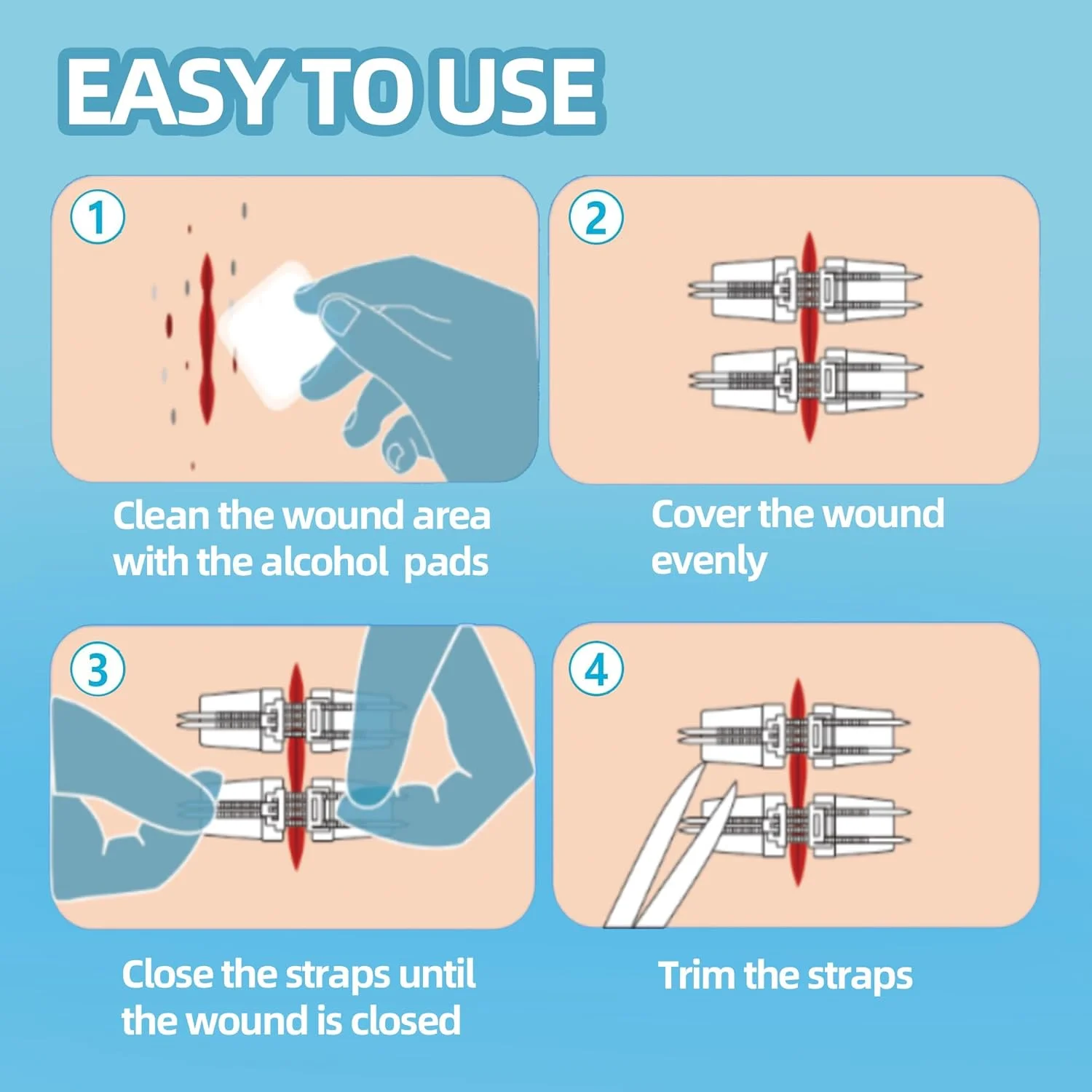 بسته‌های بستن زخم اضطراری Longmed - 10 عدد دستگاه بستن زخم زیپی، بخیه بدون درد، ترمیم پارگی بدون بخیه، بانداژ چسبی برای مراقبت از زخم کمک‌های اولیه (فروش مستقیم کارخانه)