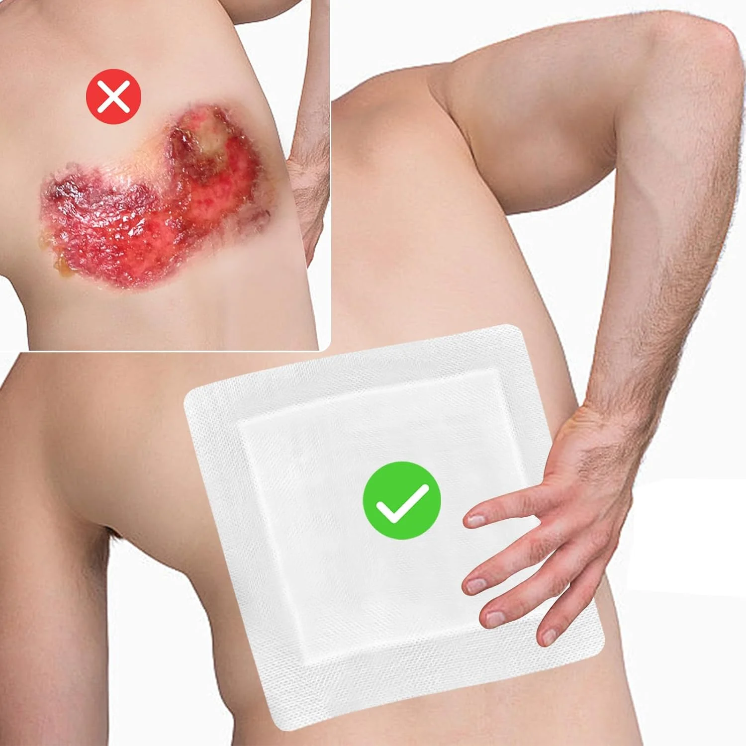 پانسمان چسبی زخم فوق العاده بزرگ، پدها و بانداژهای جاذب و تنفسی، بسته بندی جداگانه برای مراقبت از زخم بعد از جراحی، سوختگی، بریدگی، خراشیدگی (25x25 سانتی متر، 6 عدد) پانسمان چسبی زخم فوق العاده بزرگ، پدها و بانداژهای جاذب و تنفسی، بسته بندی جداگانه برای مراقبت از زخم بعد از جراحی، سوختگی، بریدگی، خراشیدگی (25x25 سانتی متر، 6 عدد)