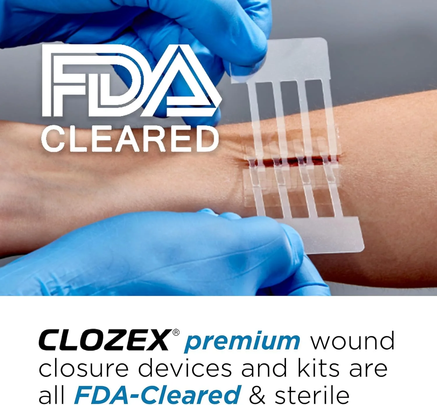 کیت کامل بخیه اضطراری Clozex - ترمیم زخم بدون نیاز به بخیه. دستگاه بستن پوست با مجوز FDA برای 2 زخم جداگانه یا ترکیب برای طول 2.5 اینچ کیت کامل بخیه اضطراری Clozex - ترمیم زخم بدون نیاز به بخیه. دستگاه بستن پوست با مجوز FDA برای 2 زخم جداگانه یا ترکیب برای طول 2.5 اینچ