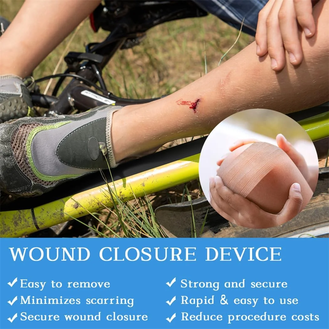 نوار بستن زخم پوست 24 عددی، نوارهای بخیه زخم، دستگاه بستن زخم اضطراری، کیت بستن پارگی، ترمیم زخم ها بدون بخیه، 12x100 میلی متر نوار بستن زخم پوست 24 عددی، نوارهای بخیه زخم، دستگاه بستن زخم اضطراری، کیت بستن پارگی، ترمیم زخم ها بدون بخیه، 12x100 میلی متر