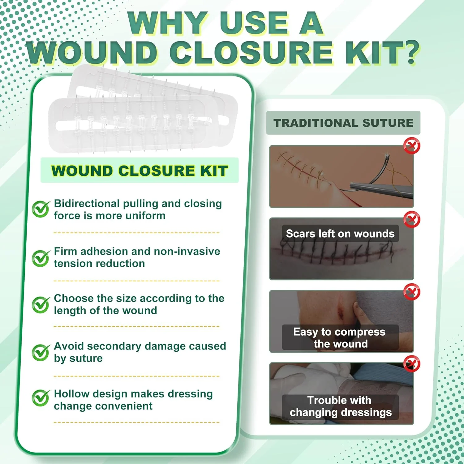 نوارهای بستن زخم بزرگ استری، چسب زخم پروانهای، دستگاه بستن زخم اضطراری، ترمیم پارگی جراحی بدون بخیه برای مراقبت از زخم بزرگ، بستن سریع پوست با درجه بیمارستانی برای خانه، فضای باز نوارهای بستن زخم بزرگ استری، چسب زخم پروانهای، دستگاه بستن زخم اضطراری، ترمیم پارگی جراحی بدون بخیه برای مراقبت از زخم بزرگ، بستن سریع پوست با درجه بیمارستانی برای خانه، فضای باز