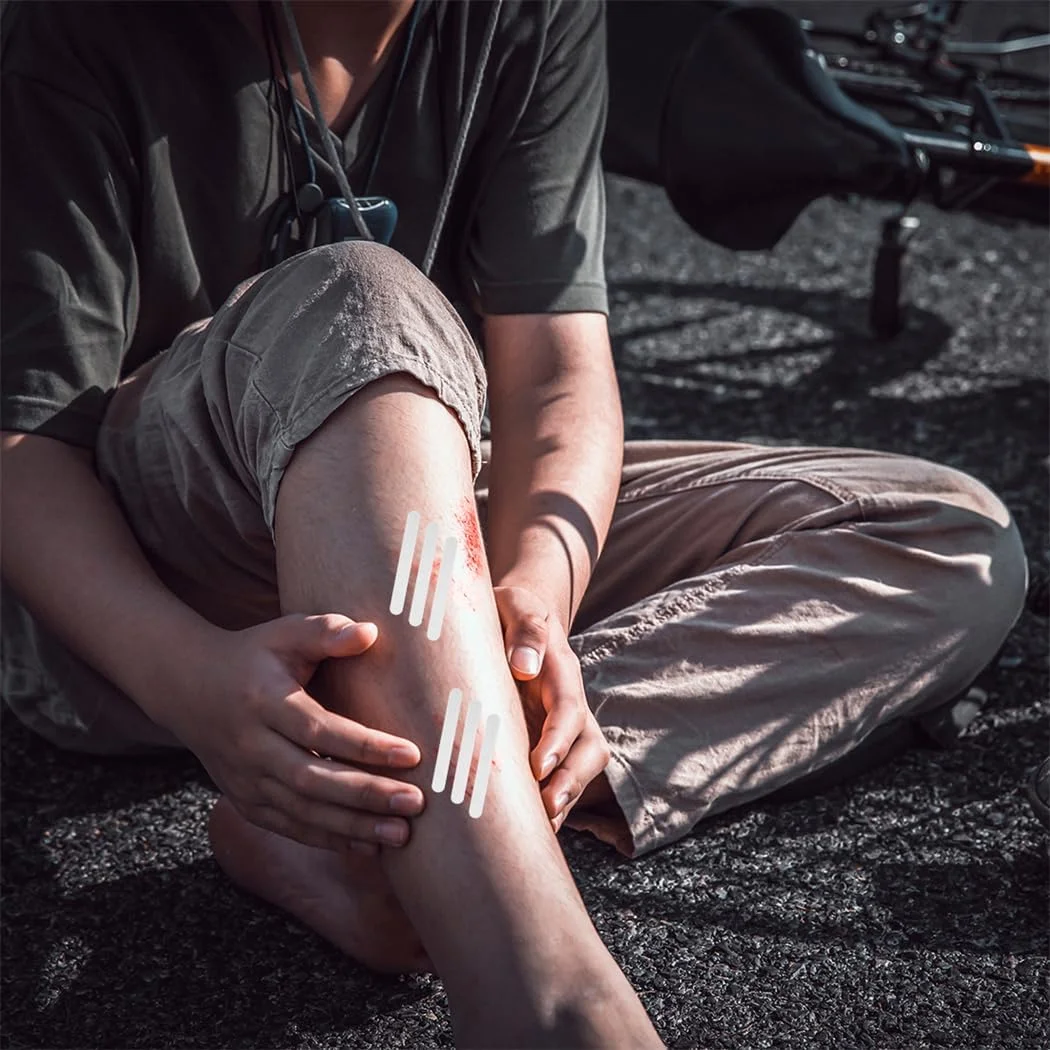 نوار بستن زخم پوست 24 عددی، نوارهای بخیه زخم، دستگاه بستن زخم اضطراری، کیت بستن پارگی، ترمیم زخم ها بدون بخیه، 12x100 میلی متر نوار بستن زخم پوست 24 عددی، نوارهای بخیه زخم، دستگاه بستن زخم اضطراری، کیت بستن پارگی، ترمیم زخم ها بدون بخیه، 12x100 میلی متر