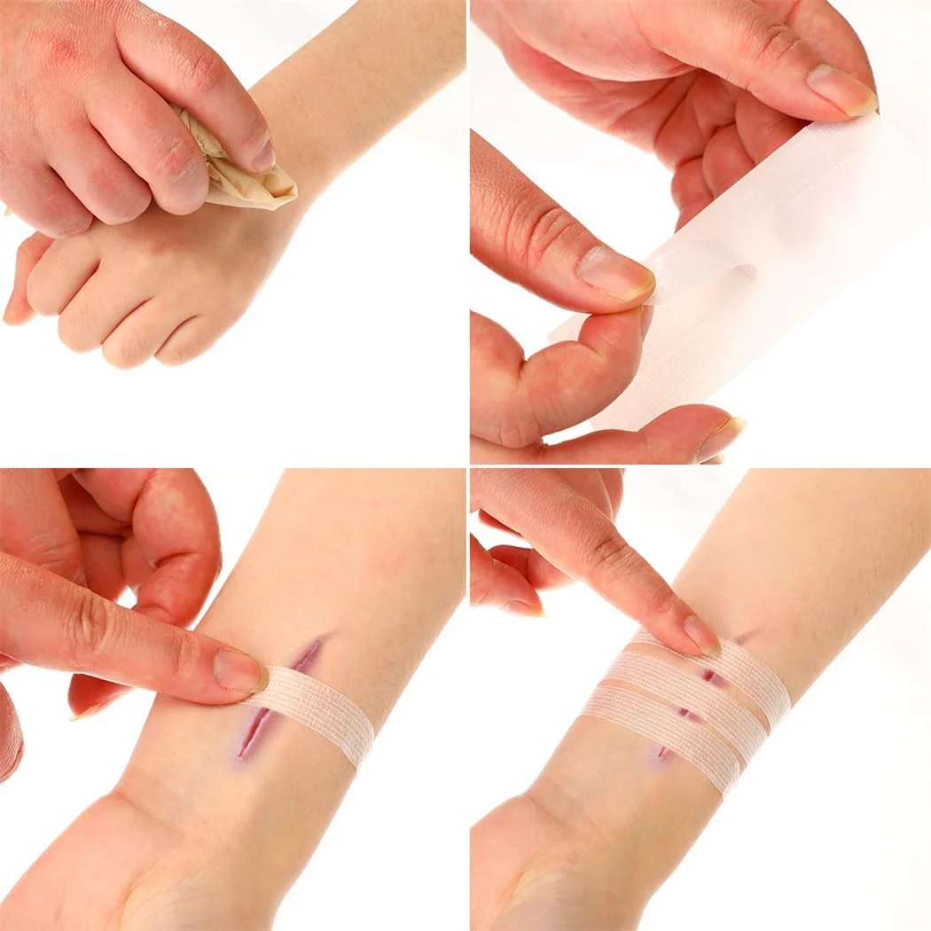 نوار بستن زخم پوست 24 عددی، نوارهای بخیه زخم، دستگاه بستن زخم اضطراری، کیت بستن پارگی، ترمیم زخم ها بدون بخیه، 12x100 میلی متر نوار بستن زخم پوست 24 عددی، نوارهای بخیه زخم، دستگاه بستن زخم اضطراری، کیت بستن پارگی، ترمیم زخم ها بدون بخیه، 12x100 میلی متر