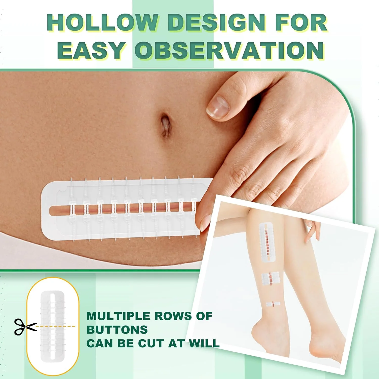 نوارهای بستن زخم بزرگ استری، چسب زخم پروانهای، دستگاه بستن زخم اضطراری، ترمیم پارگی جراحی بدون بخیه برای مراقبت از زخم بزرگ، بستن سریع پوست با درجه بیمارستانی برای خانه، فضای باز نوارهای بستن زخم بزرگ استری، چسب زخم پروانهای، دستگاه بستن زخم اضطراری، ترمیم پارگی جراحی بدون بخیه برای مراقبت از زخم بزرگ، بستن سریع پوست با درجه بیمارستانی برای خانه، فضای باز