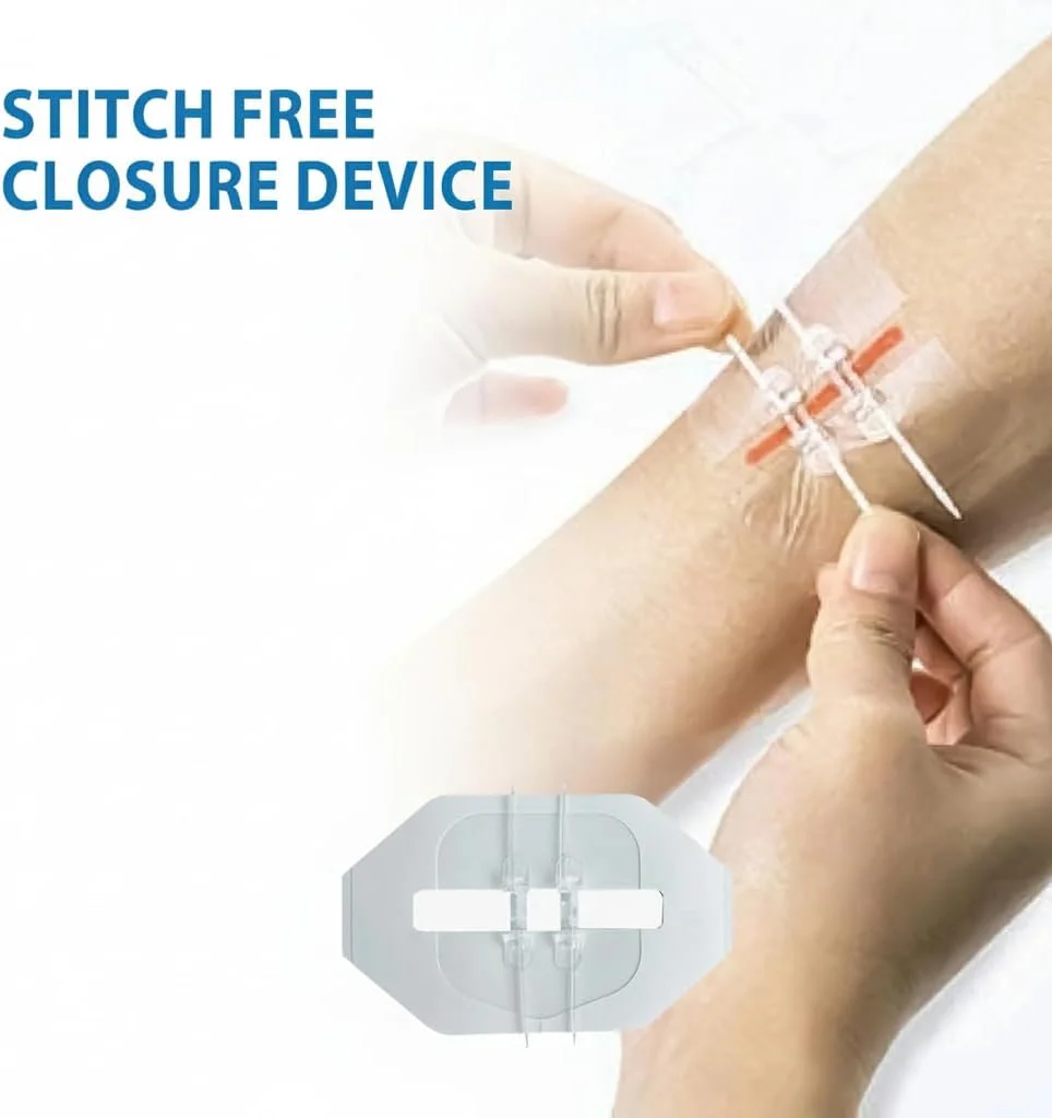 چسب بخیه Azonee برای ترمیم بریدگی های جراحی، لخته شدن سریع خون، دستگاه بستن زخم اضطراری 1 عدد برای بهبود سریع و استفاده آسان