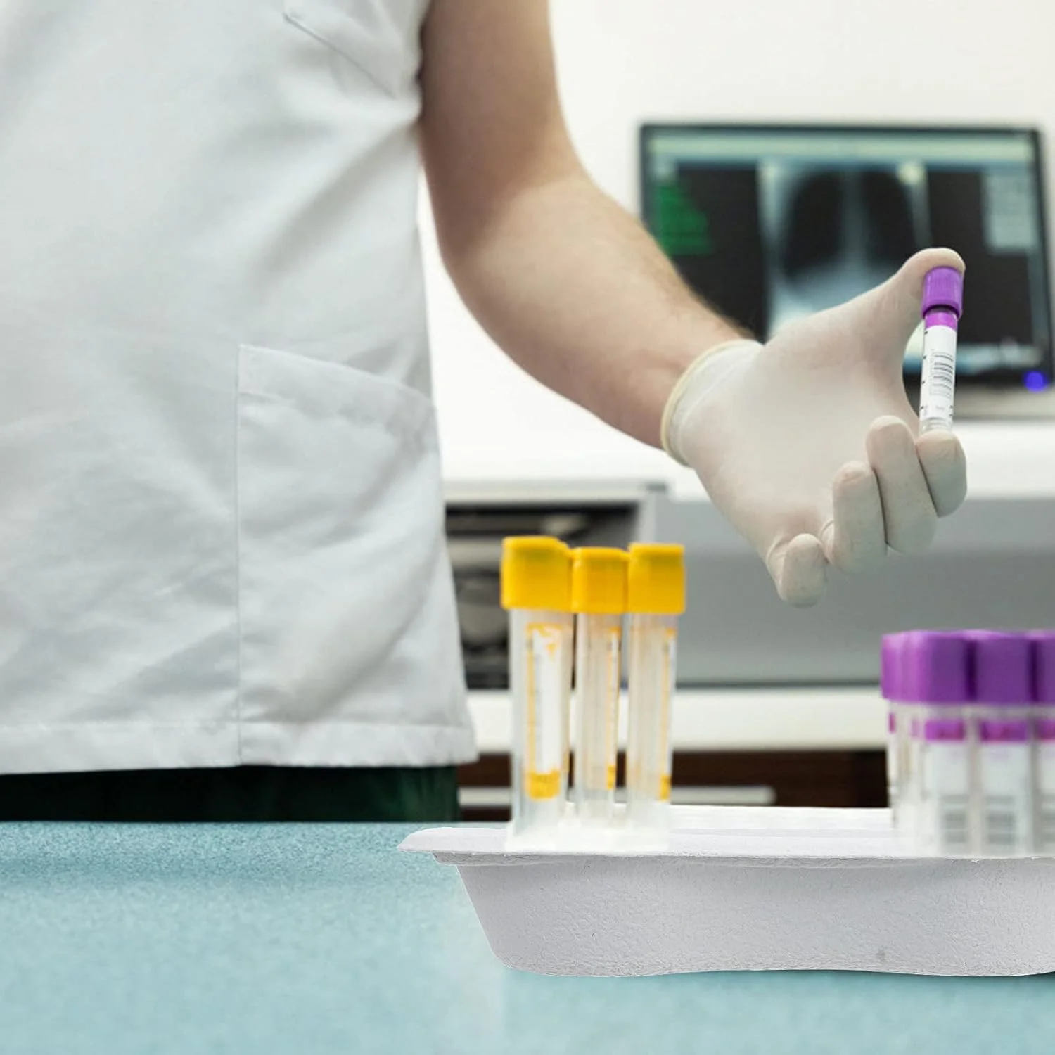 تجهیزات آزمایشگاهی 20 عددی صفحه ذخیره سازی چند منظوره بشقاب کلیوی شکل نگهدارنده سینی یکبار مصرف تجهیزات آزمایشگاهی 20 عددی صفحه ذخیره سازی چند منظوره بشقاب کلیوی شکل نگهدارنده سینی یکبار مصرف