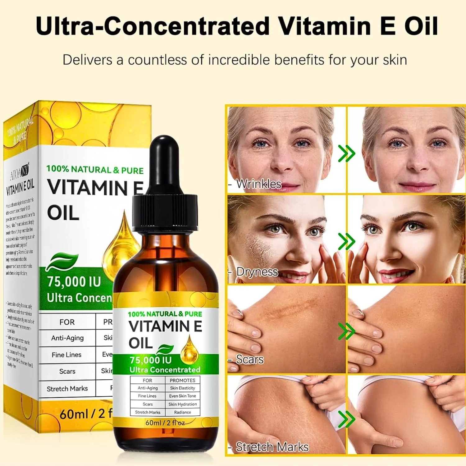 روغن ویتامین E برای پوست، صورت، جای زخم، مو و ناخن - روغن ویتامین E 100% خالص 75000 IU - کاهش خطوط ریز و مرطوب کننده پوست - سرم ویتامین E طبیعی برای جای زخم، خشکی، چین و چروک و ترک های پوستی روغن ویتامین E برای پوست، صورت، جای زخم، مو و ناخن - روغن ویتامین E 100% خالص 75000 IU - کاهش خطوط ریز و مرطوب کننده پوست - سرم ویتامین E طبیعی برای جای زخم، خشکی، چین و چروک و ترک های پوستی