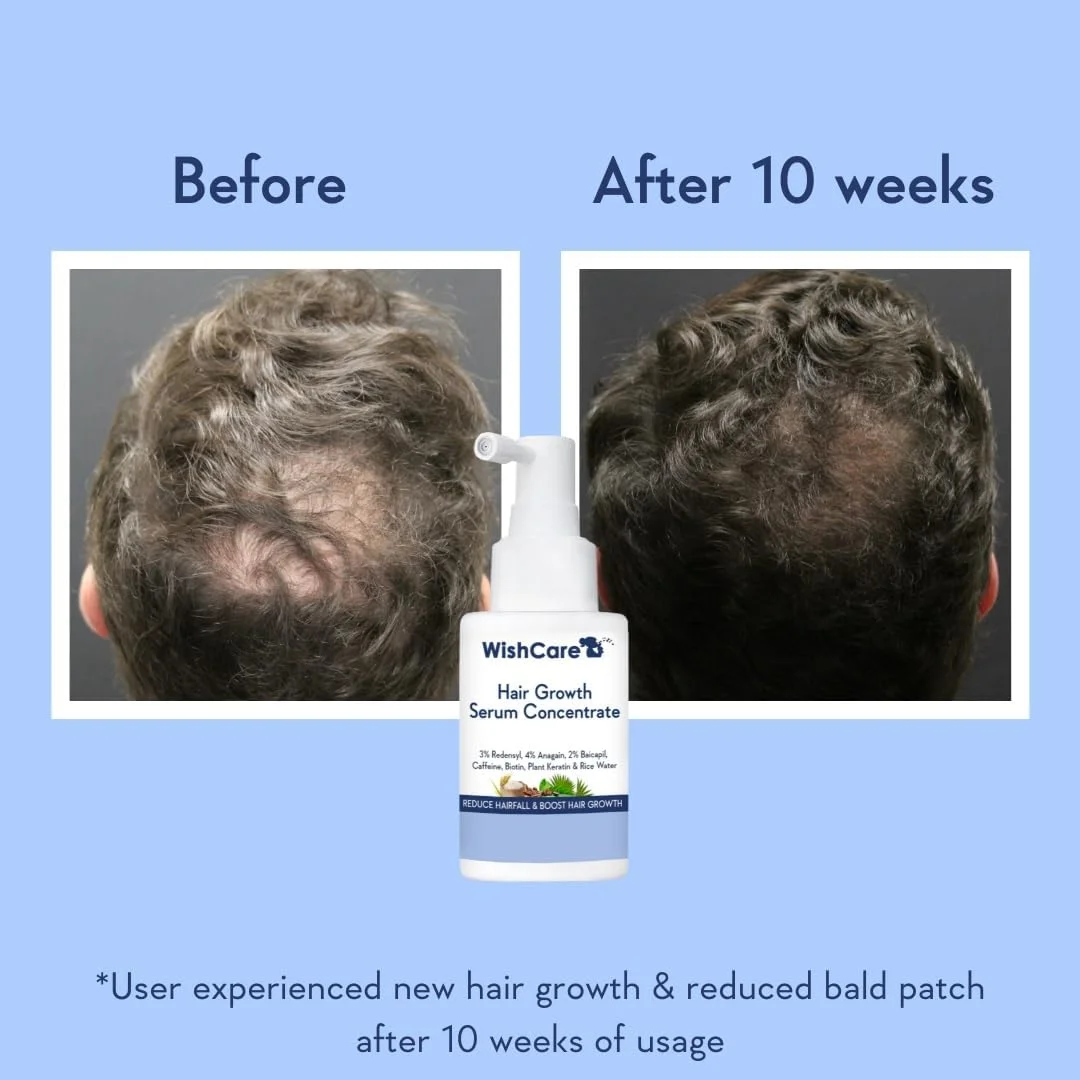 سرم کنسانتره رشد مو WishCare - 3% Redensyl، 4% Anagain، 2% Baicapil، کافئین، بیوتین و آب برنج - سرم مو رزماری برای کنترل ریزش مو و رشد مو 30 میلی لیتر