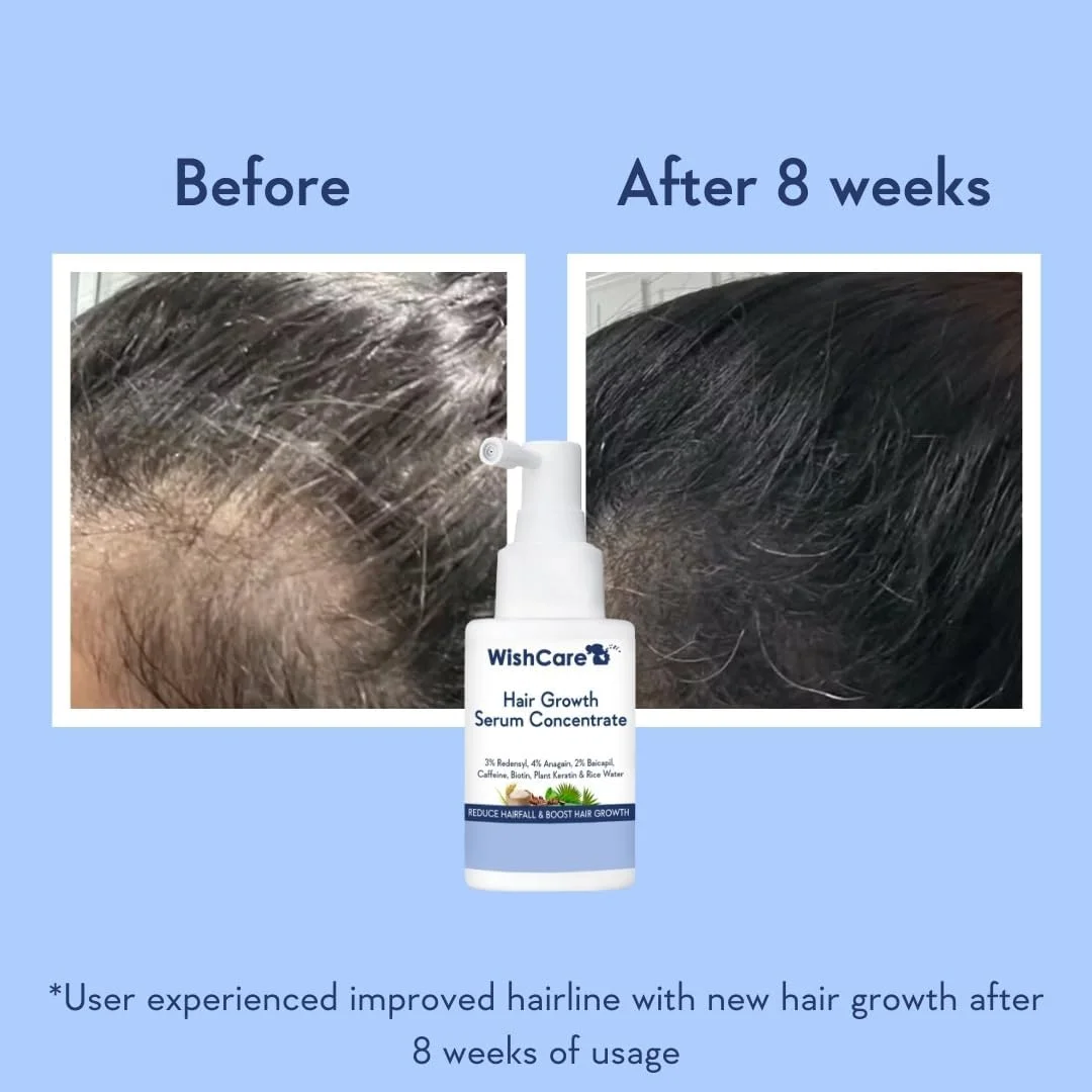 سرم کنسانتره رشد مو WishCare - 3% Redensyl، 4% Anagain، 2% Baicapil، کافئین، بیوتین و آب برنج - سرم مو رزماری برای کنترل ریزش مو و رشد مو 30 میلی لیتر