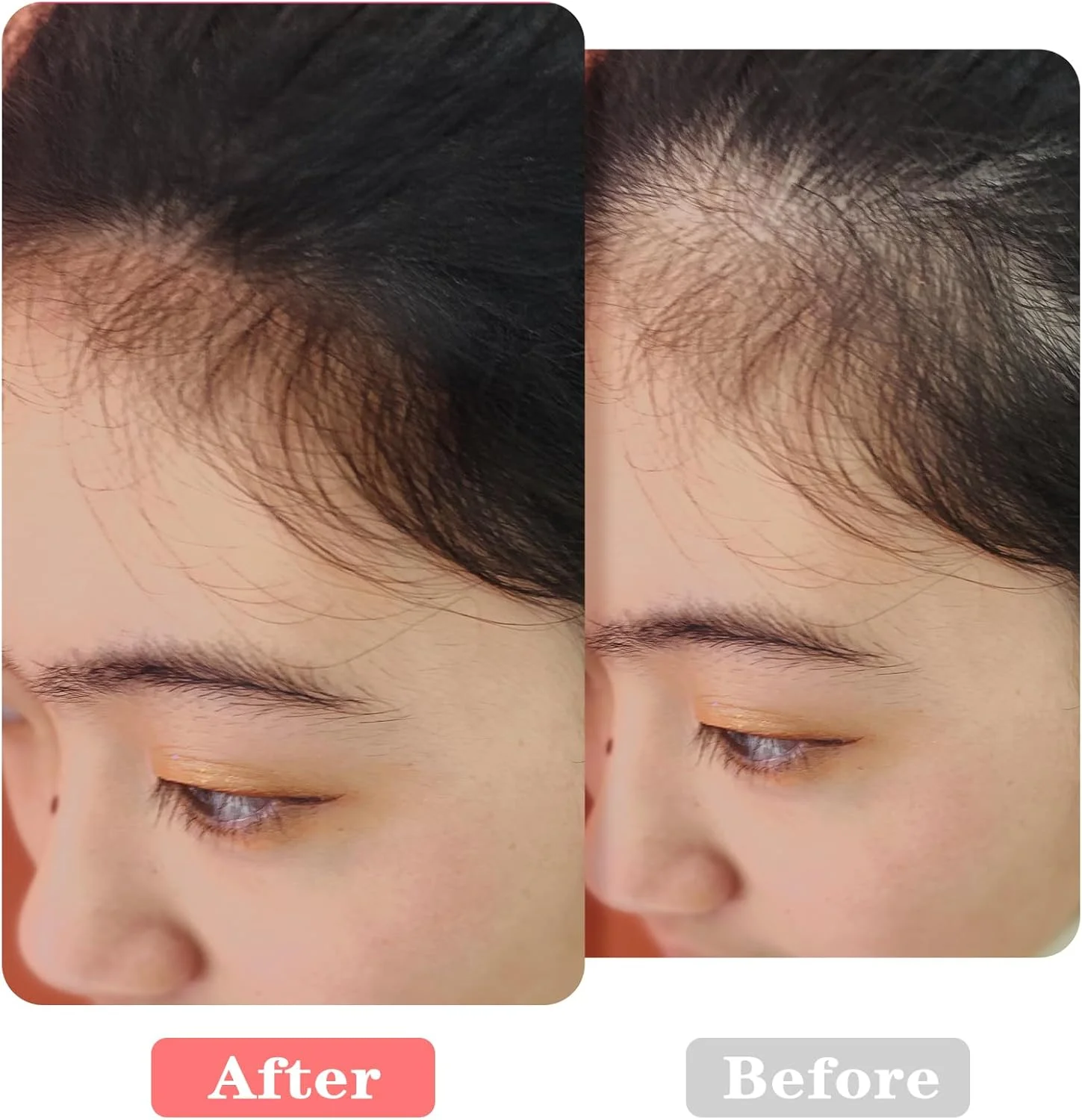 ست 3 عددی برس موی دو طرفه، ست برس کانسیلر ریشه مو با نوک اسفنجی و موهای نرم، برس کانسیلر ممتاز برای ترکیب یکپارچه، ست برس آرایشی مسافرتی برای پوشاندن و ترمیم ریشه مو ست 3 عددی برس موی دو طرفه، ست برس کانسیلر ریشه مو با نوک اسفنجی و موهای نرم، برس کانسیلر ممتاز برای ترکیب یکپارچه، ست برس آرایشی مسافرتی برای پوشاندن و ترمیم ریشه مو