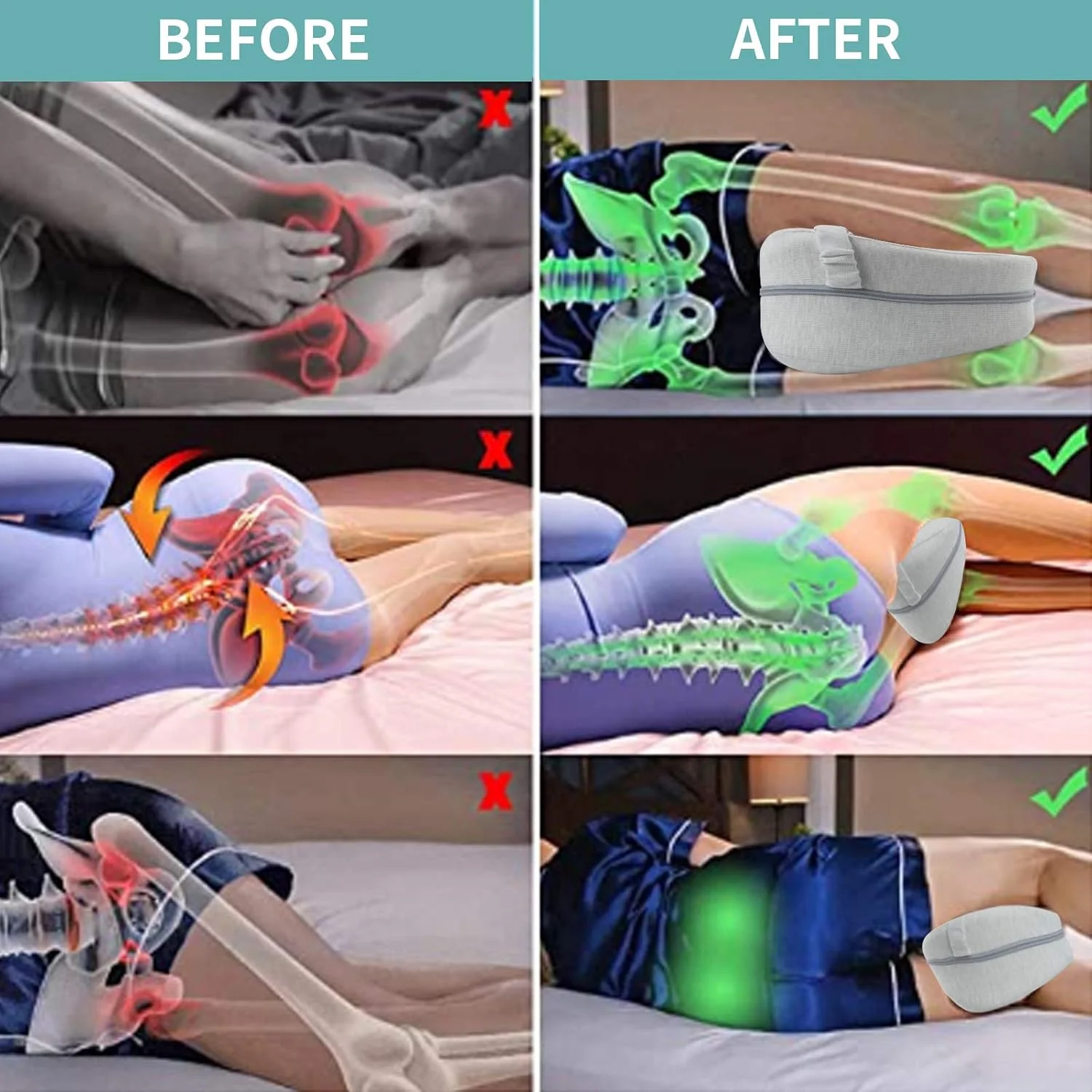 بالش زانو CREATESTAR، بالش ارگونومیک برای خوابیدن به پهلو، بالش فوم حافظه دار، ایده آل برای بالش موقعیت دهی خوابندگان جانبی با روکش بالش زانو CREATESTAR، بالش ارگونومیک برای خوابیدن به پهلو، بالش فوم حافظه دار، ایده آل برای بالش موقعیت دهی خوابندگان جانبی با روکش