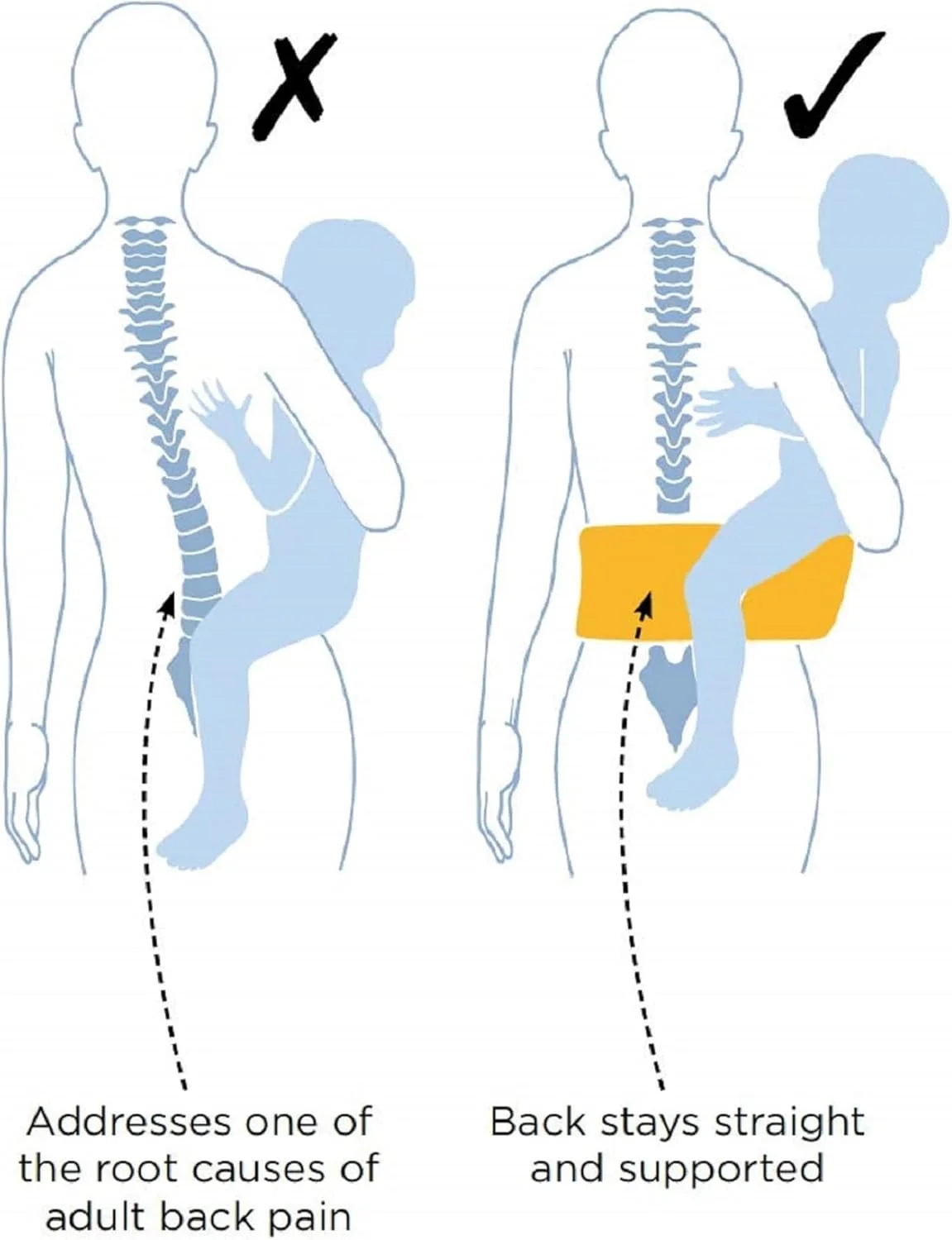 هیپسیت کودک هیپیچیک برای سنین 6 تا 36 ماه با بند قابل تنظیم - صندلی کمری سبک و محافظ کمر برای حمل کودک - آبی جین هیپسیت کودک هیپیچیک برای سنین 6 تا 36 ماه با بند قابل تنظیم - صندلی کمری سبک و محافظ کمر برای حمل کودک - آبی جین
