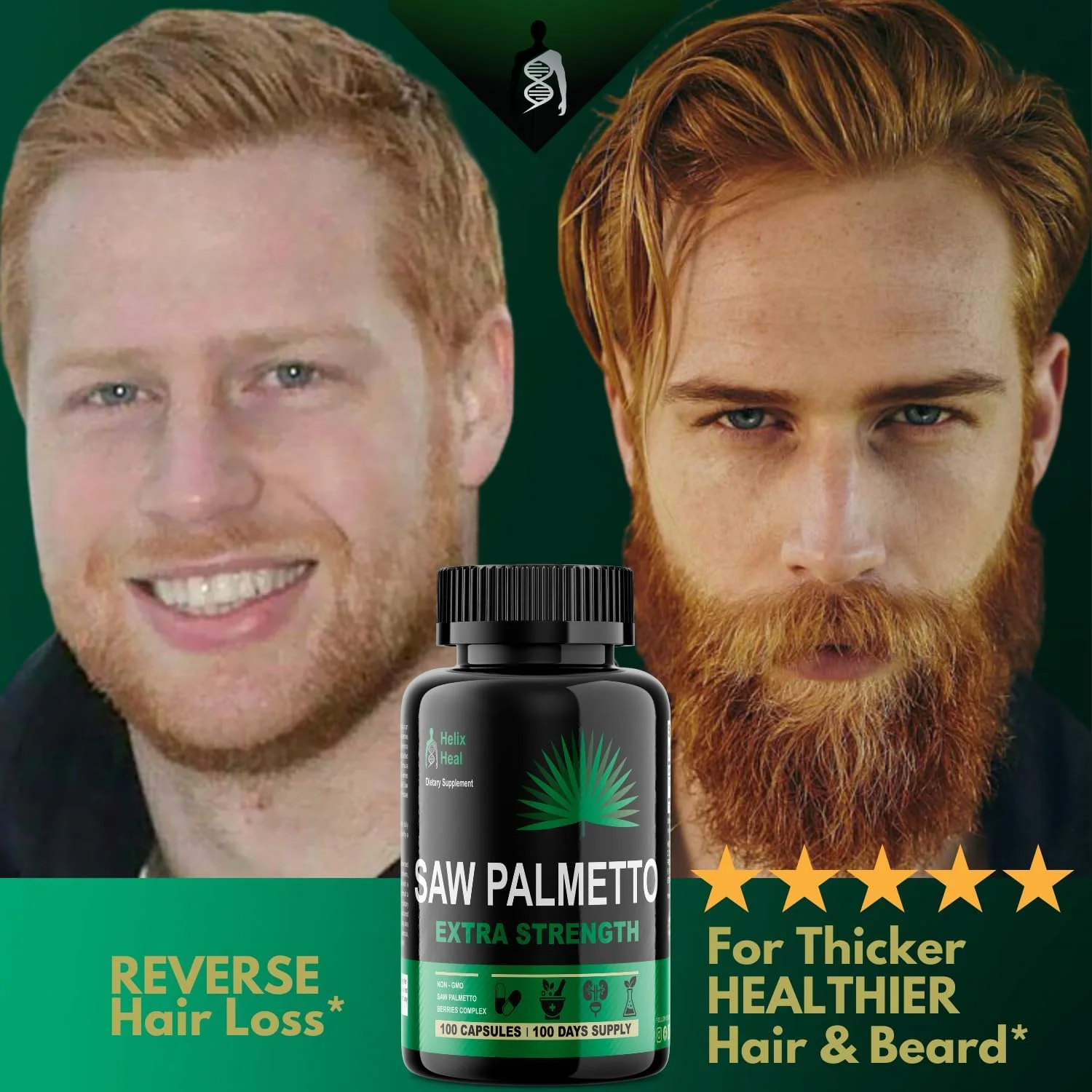 مکمل مسدود کننده DHT نخل اره ای Helix Heal - پشتیبانی از سلامت پروستات و جلوگیری از تکرر ادرار و ریزش مو + تقویت ویتامین های رشد مو برای مردان و زنان - بتا سیتوسترول ارگانیک 500 میلی گرم مکمل مسدود کننده DHT نخل اره ای Helix Heal - پشتیبانی از سلامت پروستات و جلوگیری از تکرر ادرار و ریزش مو + تقویت ویتامین های رشد مو برای مردان و زنان - بتا سیتوسترول ارگانیک 500 میلی گرم