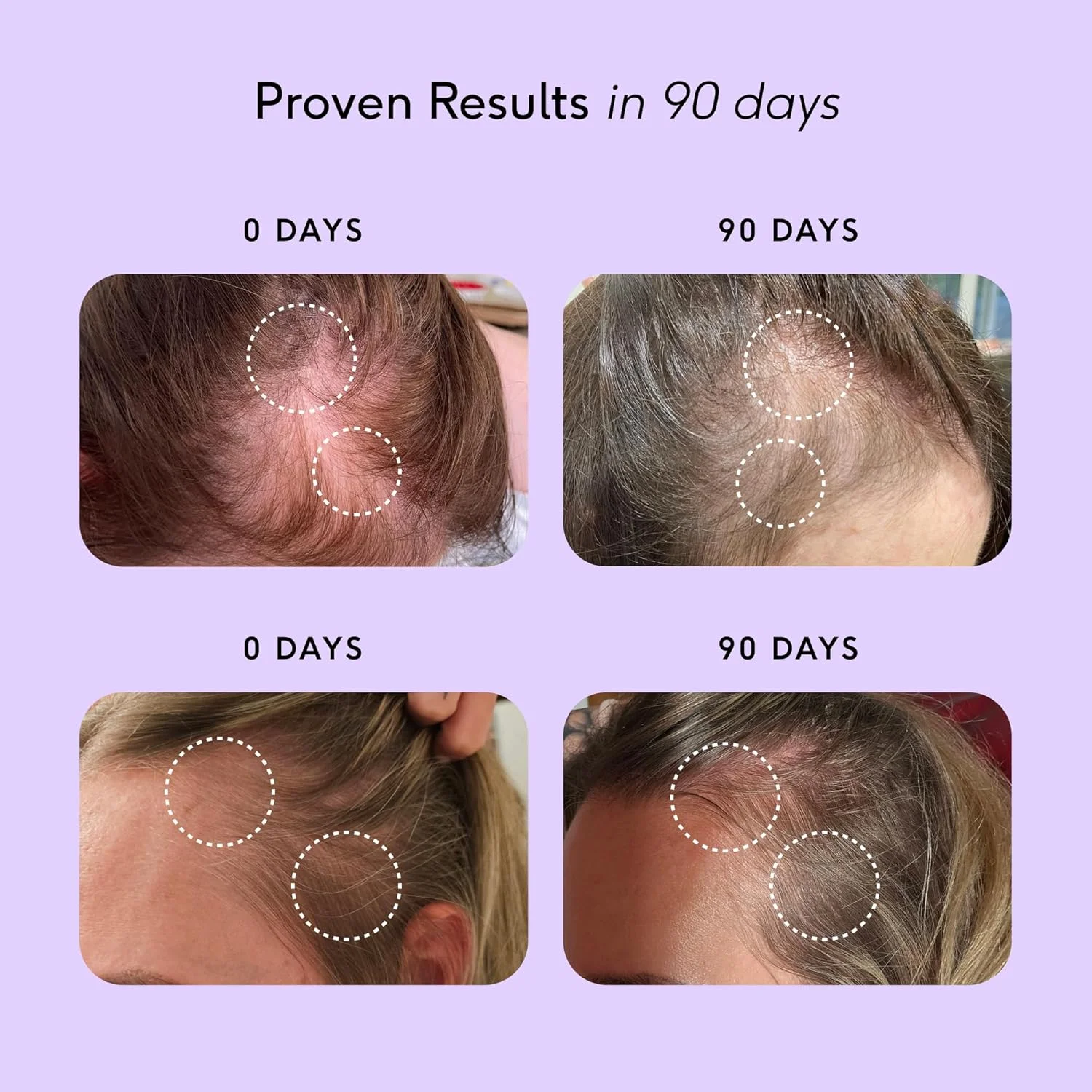 مکمل رشد مو Feel Hair Support - پشتیبانی طبیعی برای موهای نازک با کرانات و بیوتین - تقویت کننده فولیکول ها، افزایش درخشندگی و حجم - 100% حلال، وگان - 30 کپسول مکمل رشد مو Feel Hair Support - پشتیبانی طبیعی برای موهای نازک با کرانات و بیوتین - تقویت کننده فولیکول ها، افزایش درخشندگی و حجم - 100% حلال، وگان - 30 کپسول