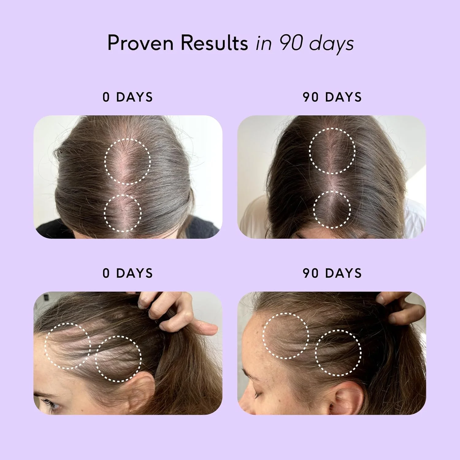مکمل رشد مو Feel Hair Support - پشتیبانی طبیعی برای موهای نازک با کرانات و بیوتین - تقویت کننده فولیکول ها، افزایش درخشندگی و حجم - 100% حلال، وگان - 30 کپسول مکمل رشد مو Feel Hair Support - پشتیبانی طبیعی برای موهای نازک با کرانات و بیوتین - تقویت کننده فولیکول ها، افزایش درخشندگی و حجم - 100% حلال، وگان - 30 کپسول