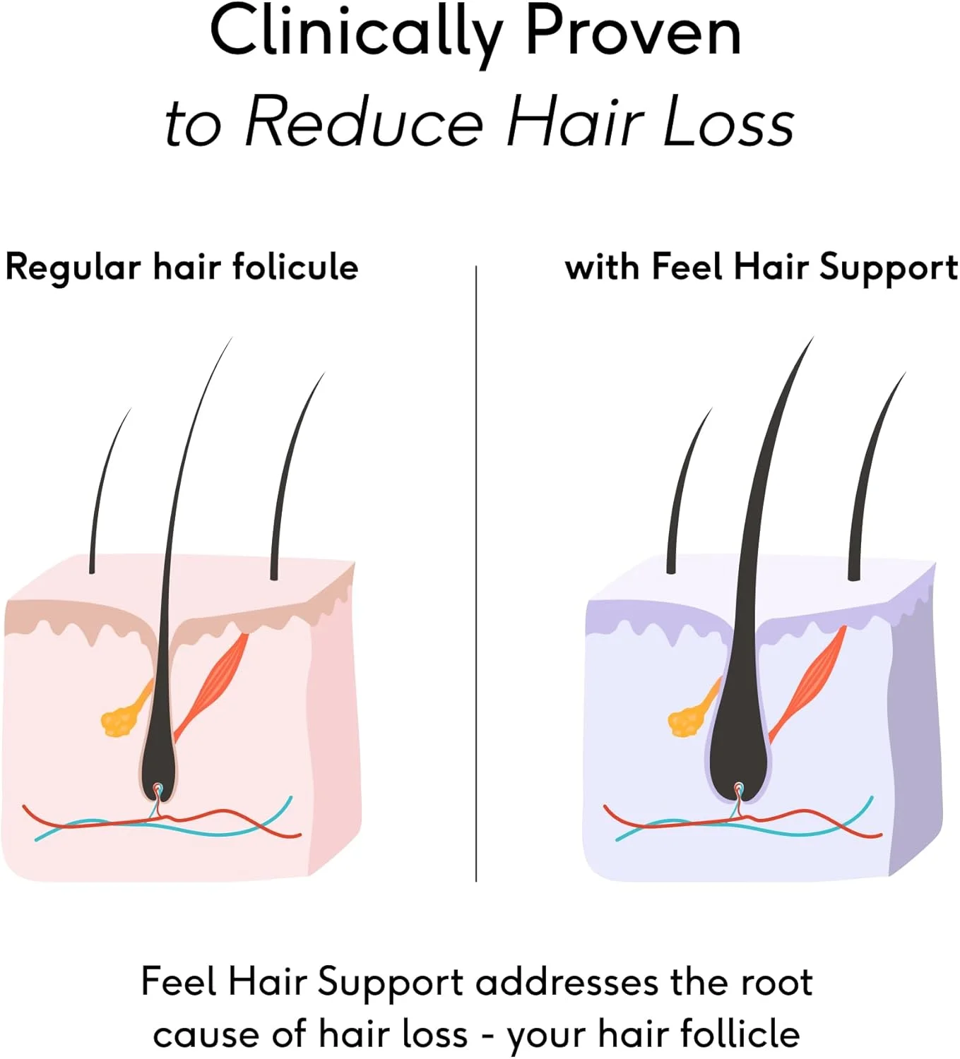 مکمل رشد مو Feel Hair Support - پشتیبانی طبیعی برای موهای نازک با کرانات و بیوتین - تقویت کننده فولیکول ها، افزایش درخشندگی و حجم - 100% حلال، وگان - 30 کپسول مکمل رشد مو Feel Hair Support - پشتیبانی طبیعی برای موهای نازک با کرانات و بیوتین - تقویت کننده فولیکول ها، افزایش درخشندگی و حجم - 100% حلال، وگان - 30 کپسول