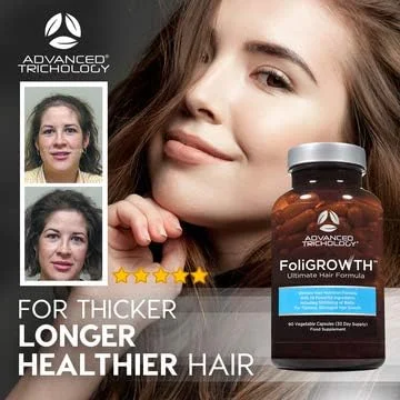 Advanced Trichology FoliGROWTH Ultimate Hair Growth Nutraceutical - Gluten Free, Vegan Formula, 3rd Party Tested - with High Potency Biotin, Stop Hair Loss - Get Thickest Strongest Hair Growth