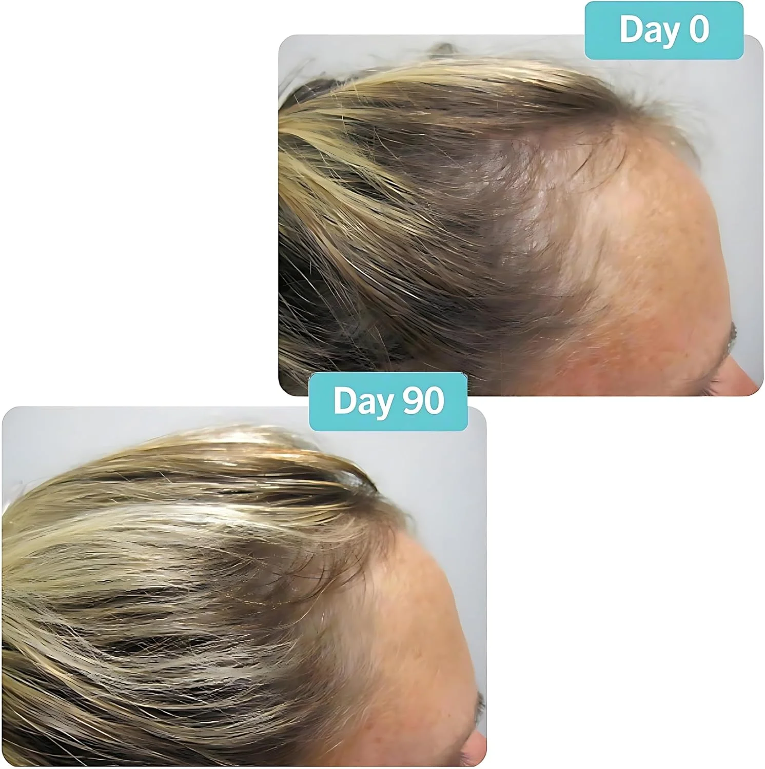 مکمل غذایی ویویسکال پرو برای سلامت پیشرفته مو، فرموله شده علمی با کلاژن دریایی و عصاره سیب، ویتامین ها و آمینو اسید - 180 عدد مکمل غذایی ویویسکال پرو برای سلامت پیشرفته مو، فرموله شده علمی با کلاژن دریایی و عصاره سیب، ویتامین ها و آمینو اسید - 180 عدد
