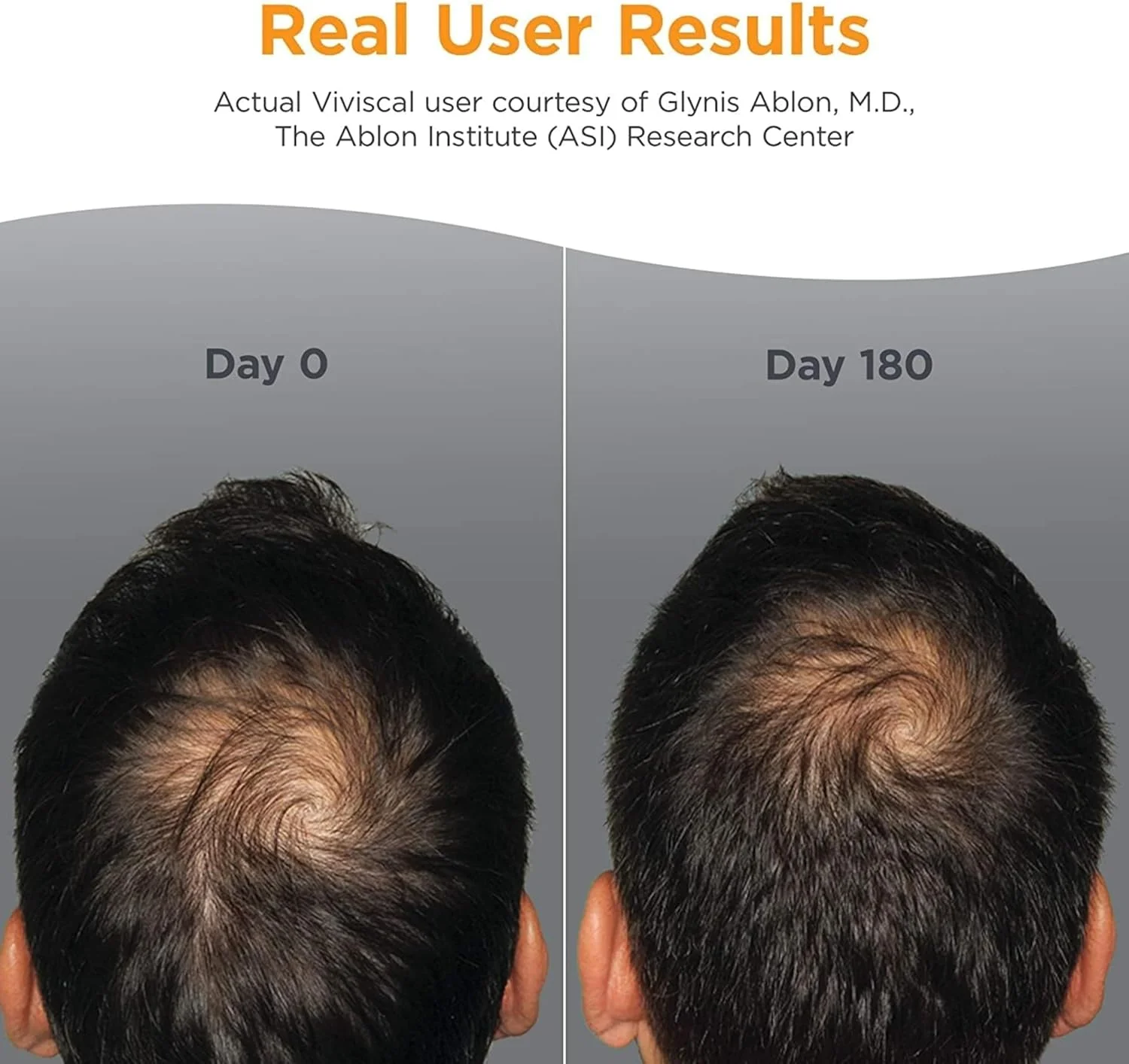 Viviscal Man Hair Growth Supplement for Men with Iron, Marine Collagen, Zinc, Vitamin C, Nourish Thinning Hair and Increase Hair Thickness, Hair Multivitamins for Men Viviscal Man Hair Growth Supplement for Men with Iron, Marine Collagen, Zinc, Vitamin C, Nourish Thinning Hair and Increase Hair Thickness, Hair Multivitamins for Men