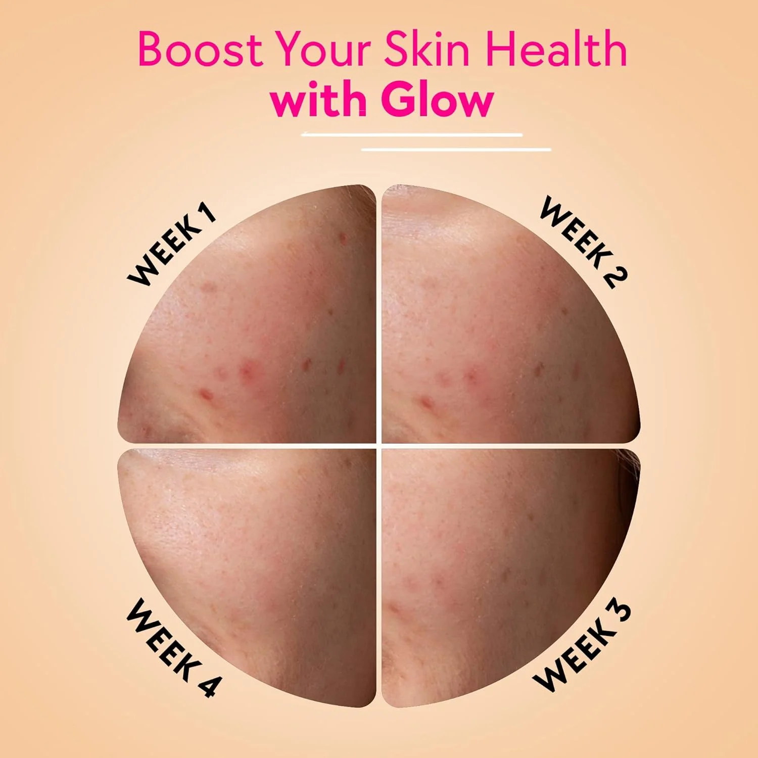 قرص جوشان Chicnutrix Glow - گلوتاتیون ژاپنی و آنتی اکسیدان های ویتامین C برای پوست شفاف و درخشان، بدون شکر، طعم لیمو توت فرنگی، 20 عدد (بسته 1 عددی) قرص جوشان Chicnutrix Glow - گلوتاتیون ژاپنی و آنتی اکسیدان های ویتامین C برای پوست شفاف و درخشان، بدون شکر، طعم لیمو توت فرنگی، 20 عدد (بسته 1 عددی)