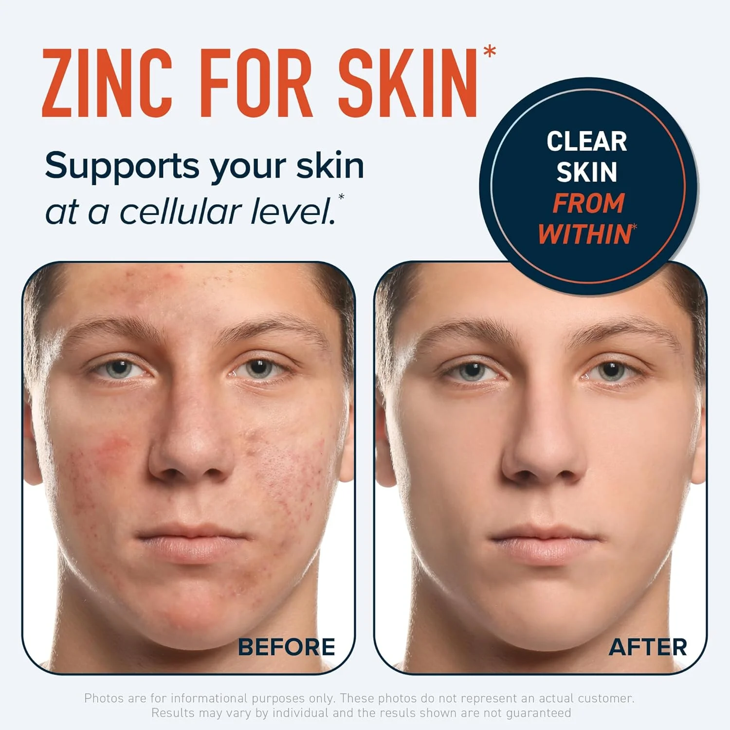 مکمل زینک (روی) به شکل میکرو بیدلت برای حمایت از سیستم ایمنی و بهبود آکنه | زینک بیس گلیسینات و اوروتات با جذب بالا به همراه 2 میلی گرم مس کلاته + ویتامین B6 | وگان، بدون گلوتن | 30 میلی گرم تعادل زینک | 60 کپسول