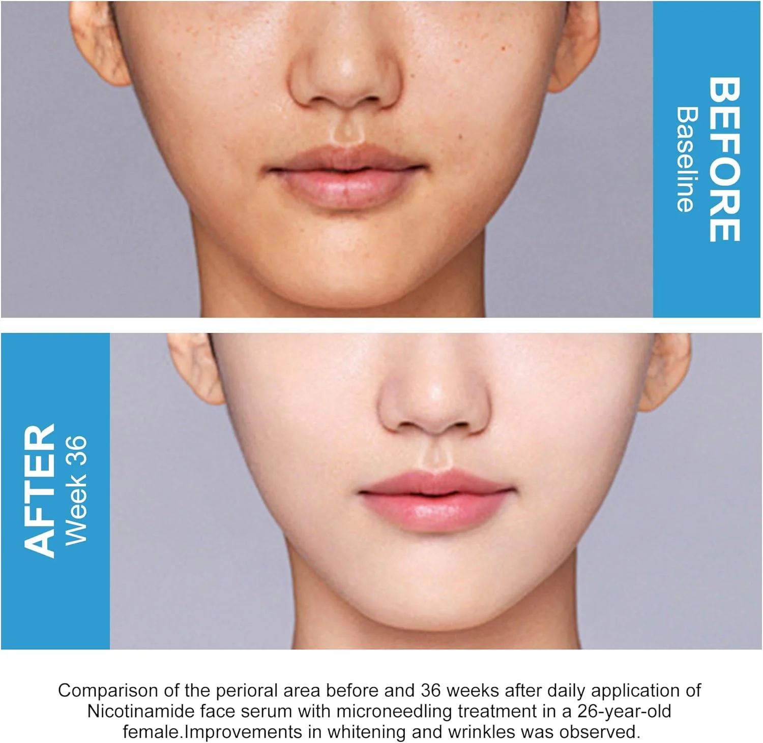 سرم صورت ساتی نیاسینامید 10% + زینک 1% حاوی B5 و هیالورونیک اسید | محو کننده جای جوش، کنترل کننده چربی، کوچک کننده منافذ، کاهش لک و قرمزی، پشتیبانی از پوست شفاف (30 میلی لیتر) سرم صورت ساتی نیاسینامید 10% + زینک 1% حاوی B5 و هیالورونیک اسید | محو کننده جای جوش، کنترل کننده چربی، کوچک کننده منافذ، کاهش لک و قرمزی، پشتیبانی از پوست شفاف (30 میلی لیتر)