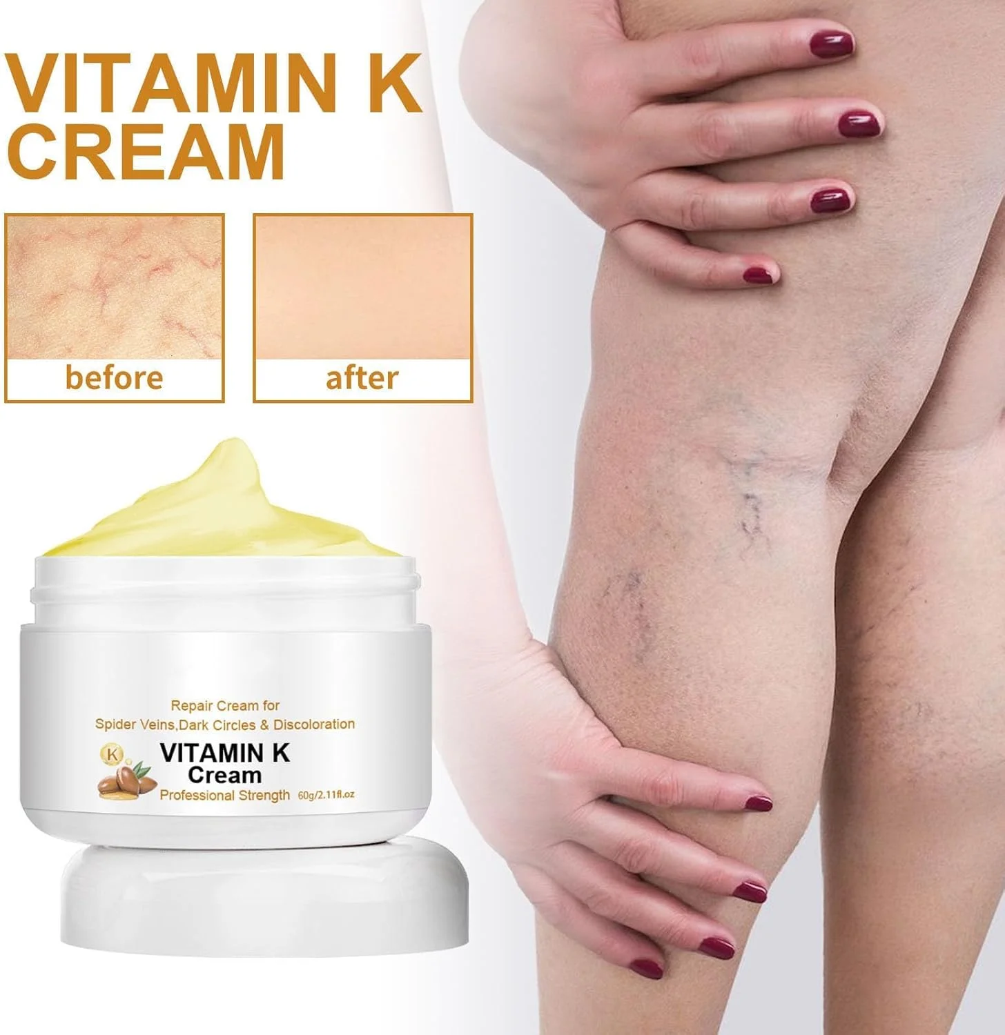 کرم معجزه آسای رگ های واریسی حاوی ویتامین K، درمان تسکین دهنده رگ ها برای پاها و صورت، کاهش دهنده ظاهر رگ های واریسی و عنکبوتی، صاف کننده پوست (2 عدد) کرم معجزه آسای رگ های واریسی حاوی ویتامین K، درمان تسکین دهنده رگ ها برای پاها و صورت، کاهش دهنده ظاهر رگ های واریسی و عنکبوتی، صاف کننده پوست (2 عدد)