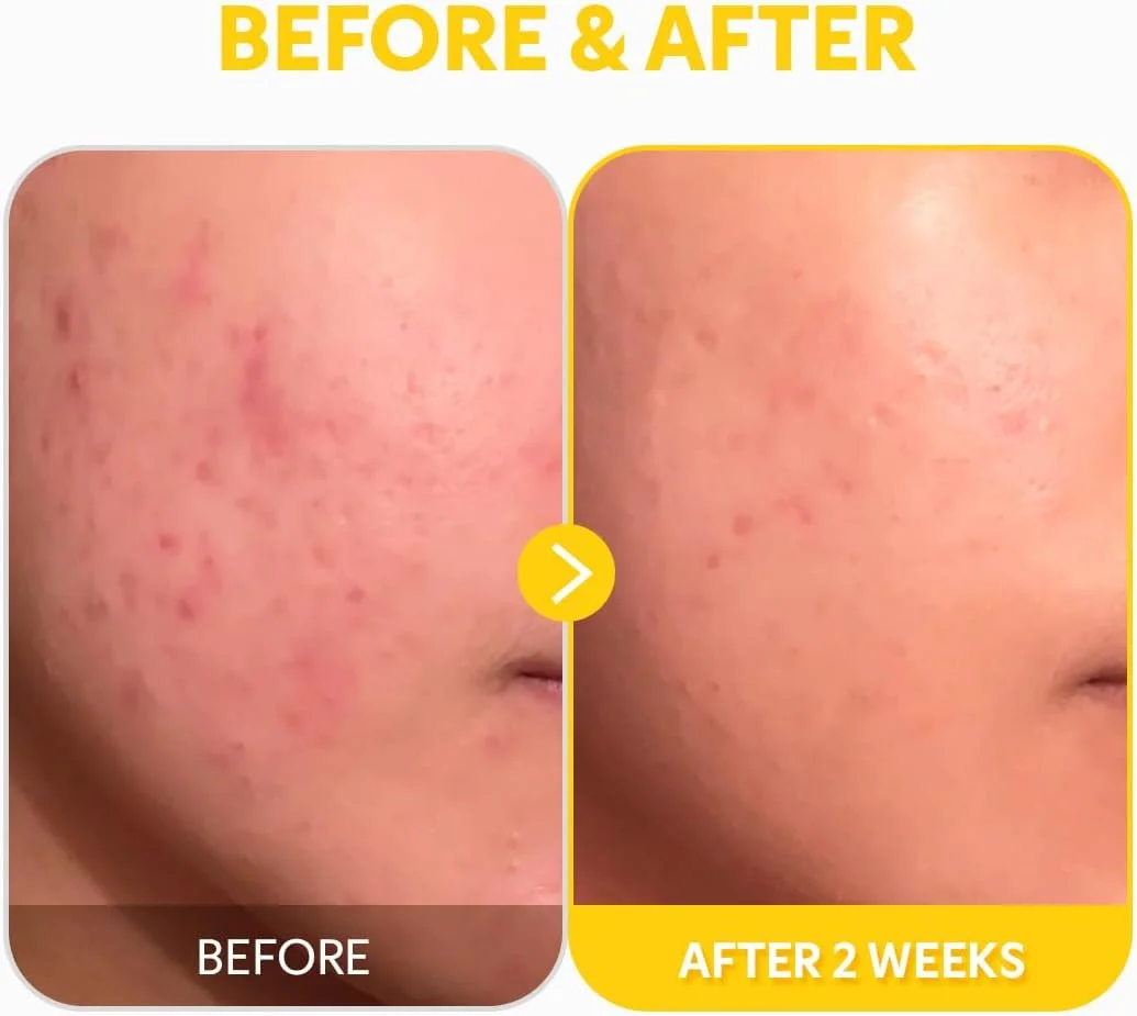 سرم صورت ویتامین C خالص 24% تیر تیر - از بین برنده لک های تیره برای پوست های حساس حاوی کلاژن، ضد پیری، یکنواخت کننده رنگ پوست، تست شده برای عدم تحریک، ضد چروک، سرم ملایم ویتامین C کره ای 30 میلی لیتر سرم صورت ویتامین C خالص 24% تیر تیر - از بین برنده لک های تیره برای پوست های حساس حاوی کلاژن، ضد پیری، یکنواخت کننده رنگ پوست، تست شده برای عدم تحریک، ضد چروک، سرم ملایم ویتامین C کره ای 30 میلی لیتر