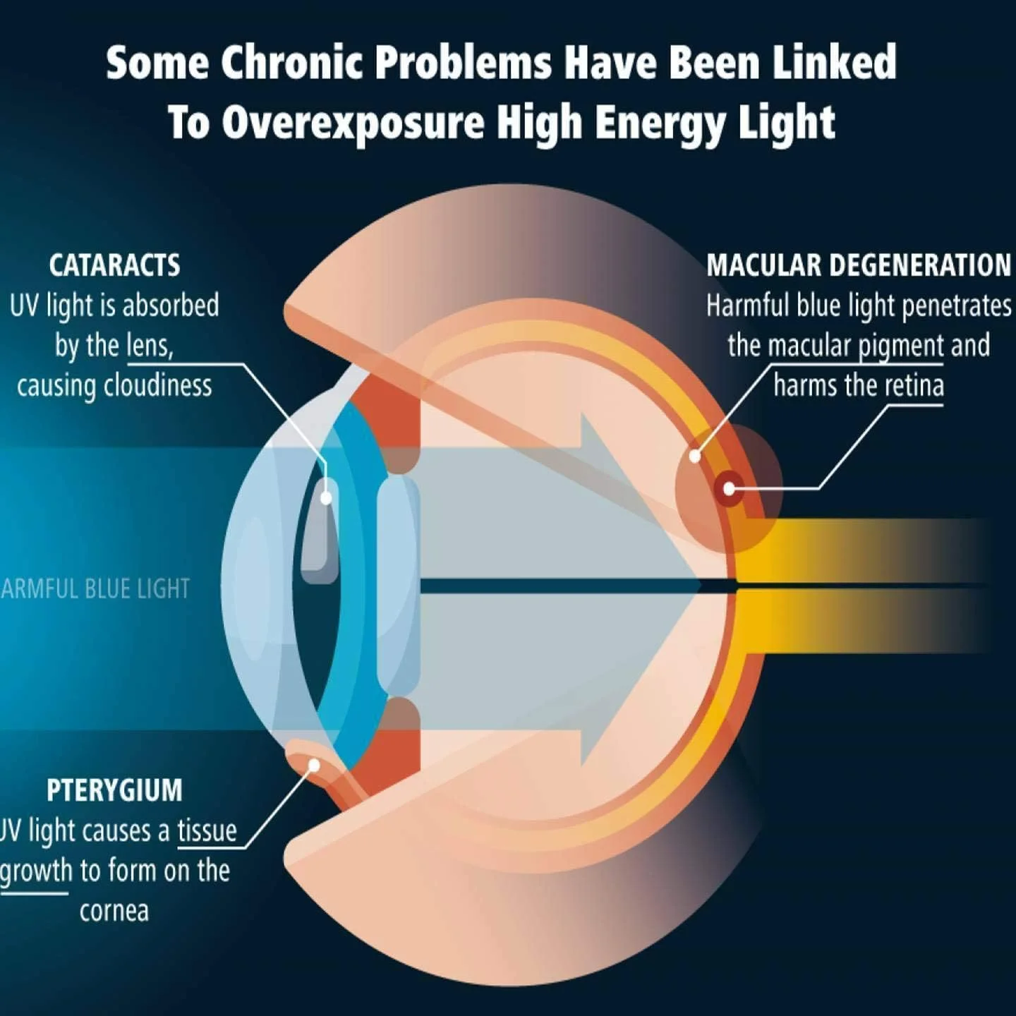 محافظ صفحه نمایش شیشه ای حرارت دیده ضد نور آبی ZenHoo برای تبلت Onn Surf 7 اینچی، محافظت از چشم، کاهش خستگی و فشار چشم محافظ صفحه نمایش شیشه ای حرارت دیده ضد نور آبی ZenHoo برای تبلت Onn Surf 7 اینچی، محافظت از چشم، کاهش خستگی و فشار چشم