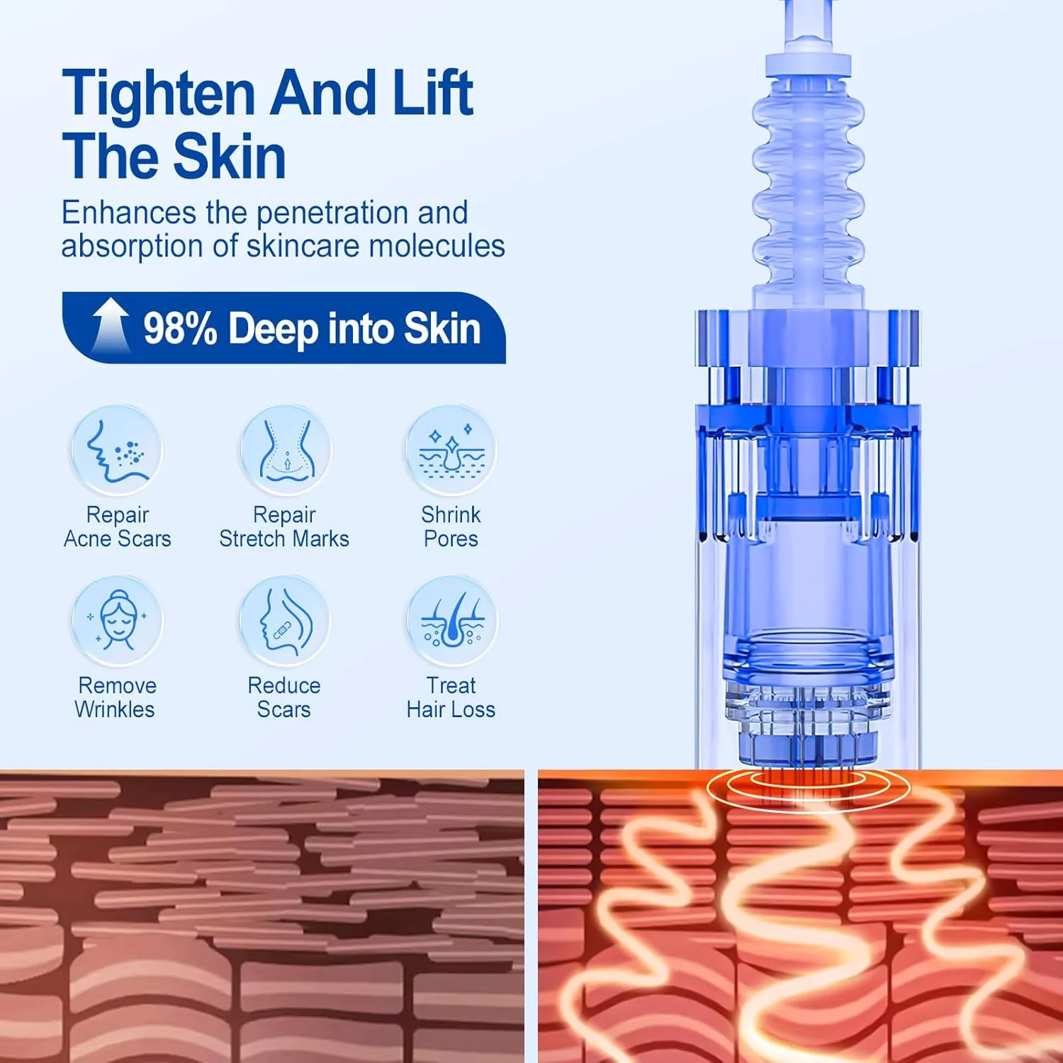سوزن های میکرونیدلینگ بلایرام درماپن 36 سر، 10 عدد سوزن درماپن برای قلم میکرونیدلینگ برقی، برای جوانسازی پوست و ضد چروک برقی درماپن