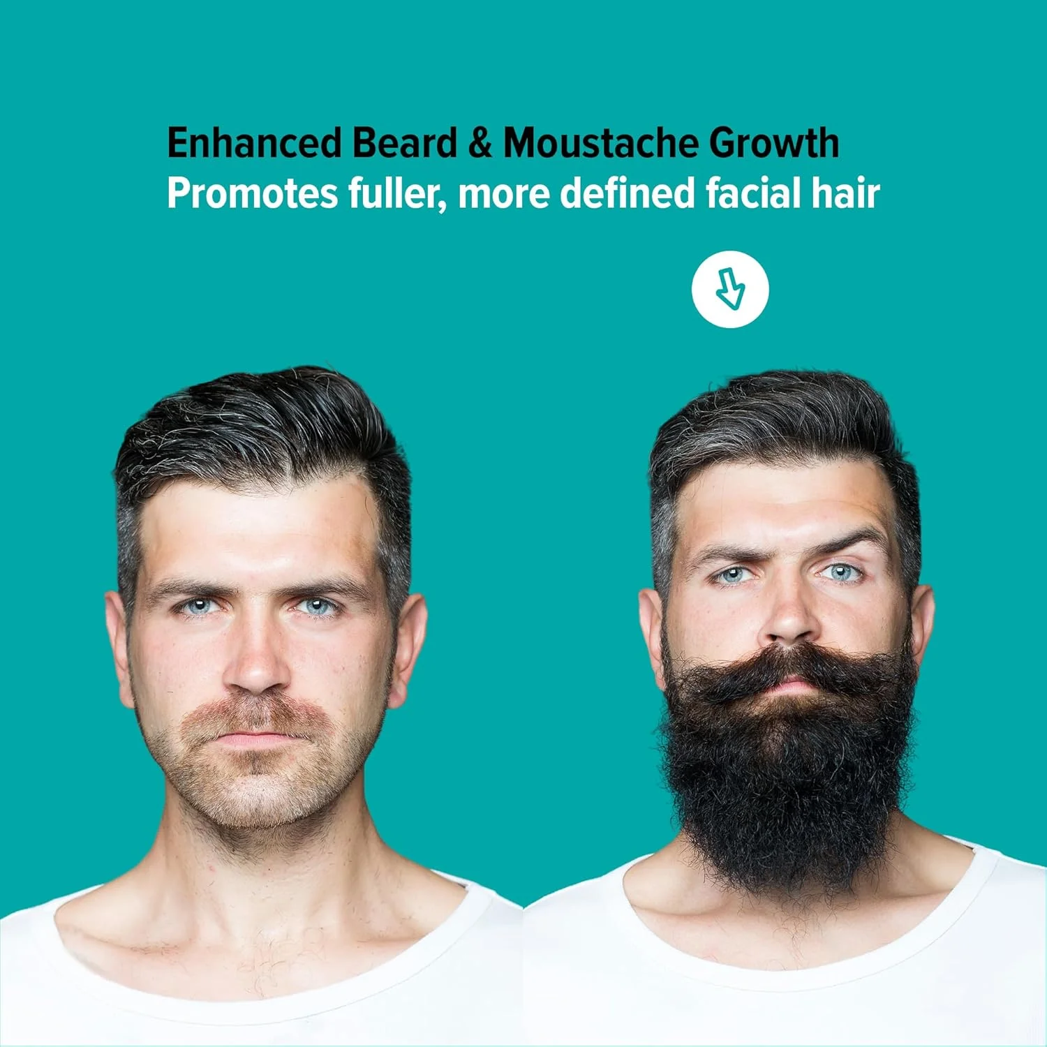 قلم میکرونیدلینگ قابل تنظیم BOLTIX – ۱۴۰ سوزن استیل ضد زنگ برای پوست و مو – ابزار حرفه ای برای زنان و مردان – شامل ۱ پد الکلی