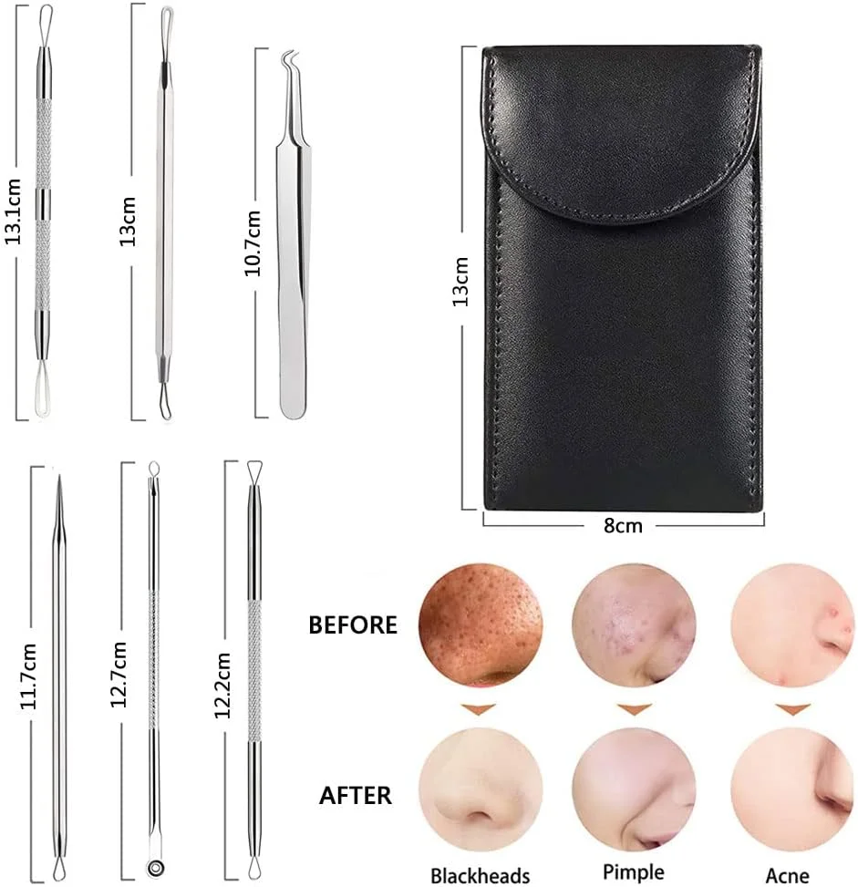 کیت موچین دقیق استیل ضد زنگ 6 در 1 ORiTi برای از بین بردن جوش های سرسیاه، جوش، آکنه، لک، موهای صورت و ابرو مناسب برای زیبایی زنان و مردان کیت موچین دقیق استیل ضد زنگ 6 در 1 ORiTi برای از بین بردن جوش های سرسیاه، جوش، آکنه، لک، موهای صورت و ابرو مناسب برای زیبایی زنان و مردان