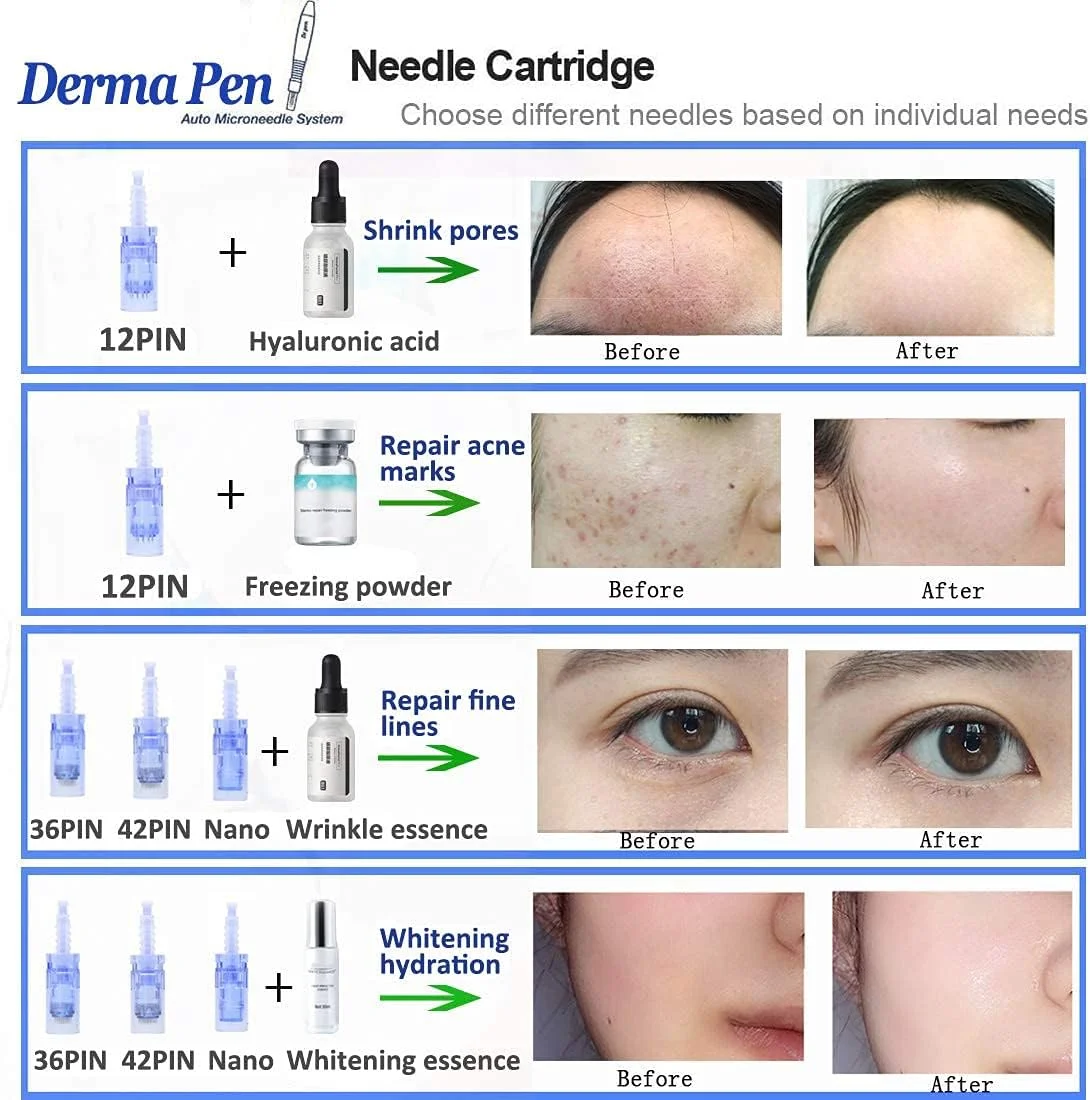 دکتر.قلم A6 Ultima قلم میکرونیدلینگ برقی تاپدایرکت، قلم درمارولر قابل تنظیم 0.25-2.5 میلیمتری برای چین و چروک، ترکهای پوستی، جای زخم، جوانسازی، همراه با 2 عدد کارتریج 12 پین، 2 عدد کارتریج 36 پین، 2 عدد کارتریج نانو گرد دکتر.قلم A6 Ultima قلم میکرونیدلینگ برقی تاپدایرکت، قلم درمارولر قابل تنظیم 0.25-2.5 میلیمتری برای چین و چروک، ترکهای پوستی، جای زخم، جوانسازی، همراه با 2 عدد کارتریج 12 پین، 2 عدد کارتریج 36 پین، 2 عدد کارتریج نانو گرد