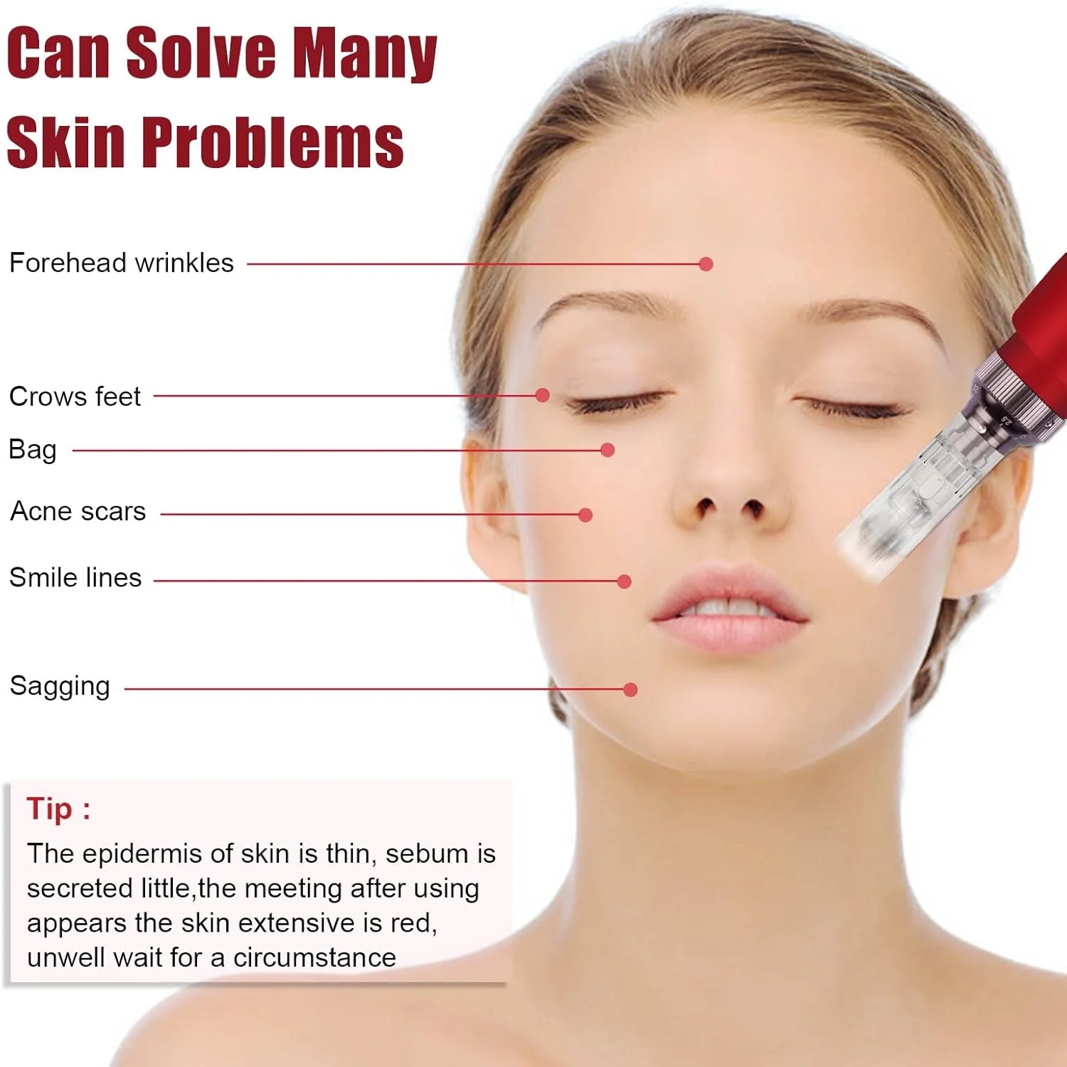 دستگاه میکرونیدلینگ مزوپن دکتر.پن N2-W شارژی/بی سیم SDERMATECH به همراه 2 کارتریج (جلوگیری از ریزش مو برای آقایان و بانوان)