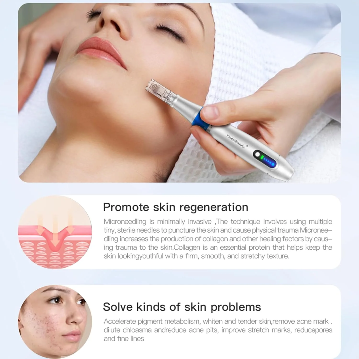 قلم میکرونیدلینگ حرفه ای با 5 سرعت، دستگاه میکرونیدلینگ بی سیم قابل تنظیم Ultima A6 Pro به همراه 2 عدد کارتریج جایگزین 12 پین، 2 عدد 24 پین، 2 عدد 36 پین