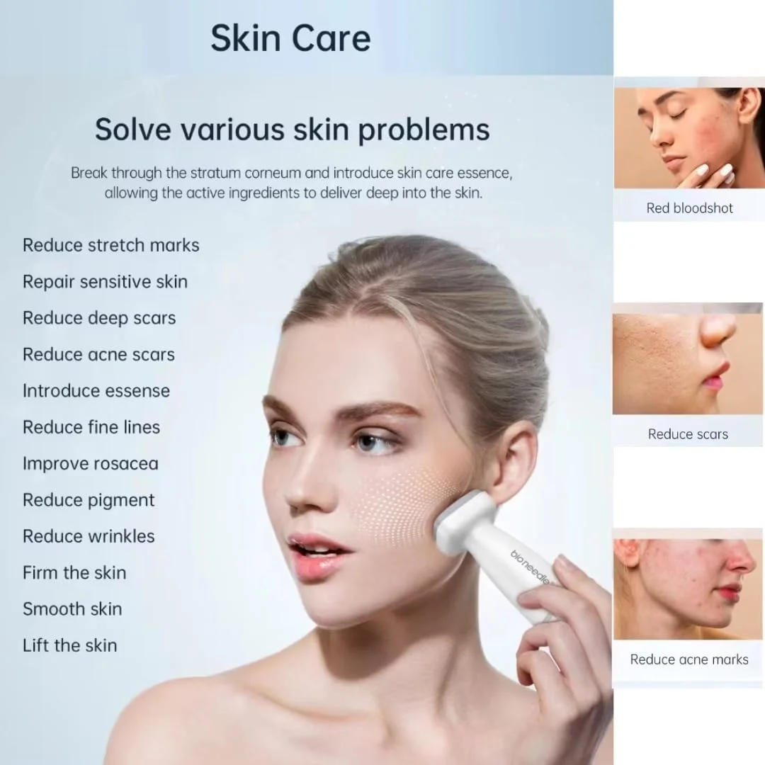 میکرونیدلینگ درما استمپ NIKITA.VIVI، دارای 120 سوزن قابل تنظیم 0-2 میلیمتری، قلم میکرونیدلینگ حرفهای استیل ضد زنگ برای زنان و مردان، مناسب برای رشد مو، مراقبت از پوست و رشد ریش میکرونیدلینگ درما استمپ NIKITA.VIVI، دارای 120 سوزن قابل تنظیم 0-2 میلیمتری، قلم میکرونیدلینگ حرفهای استیل ضد زنگ برای زنان و مردان، مناسب برای رشد مو، مراقبت از پوست و رشد ریش