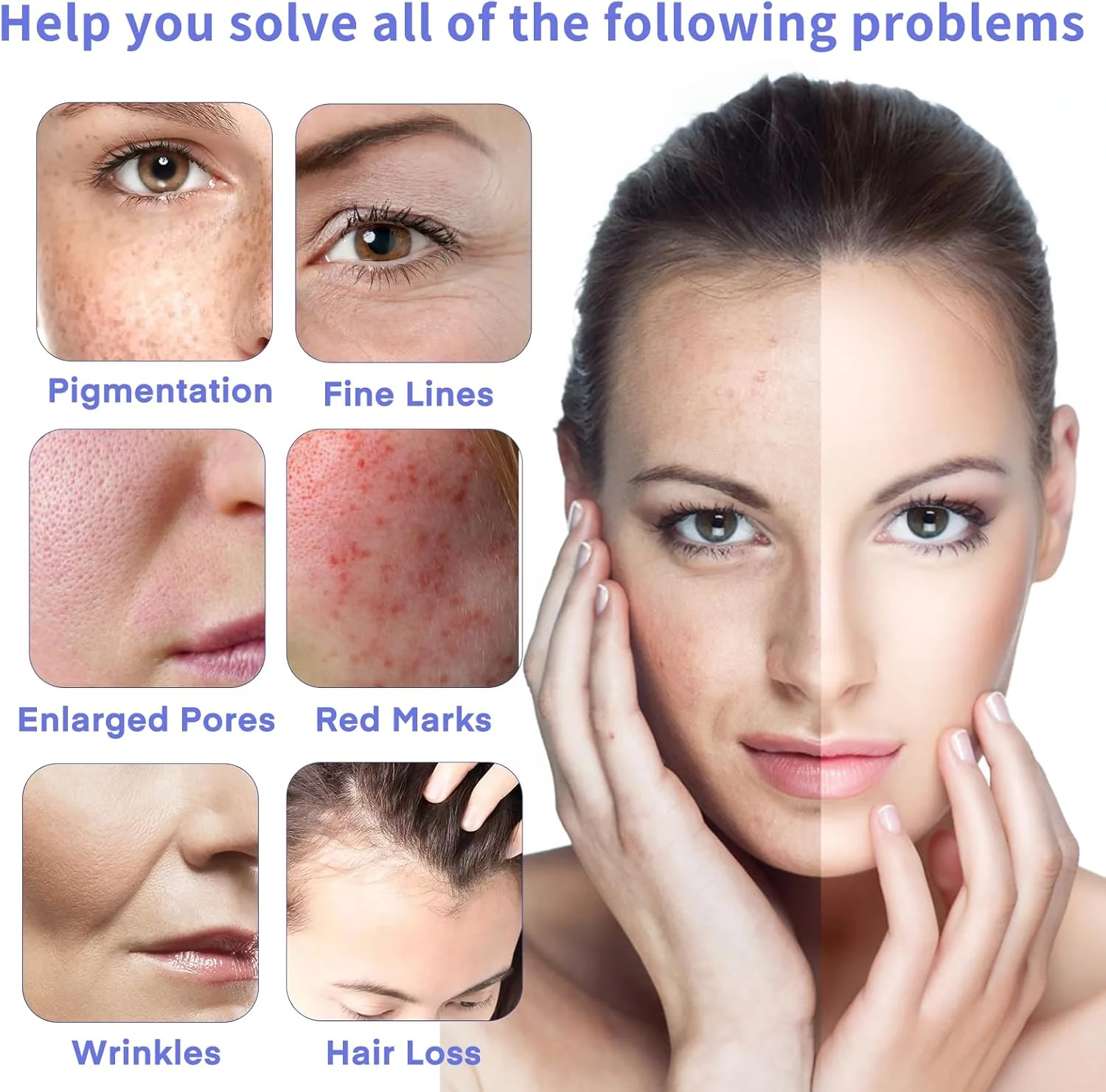 کارتریج سوزنی 36 پین MYSWEETY، بسته 20 عددی، میکرونیدل برای Dr.pen A6، سوزن های کوچک برای قلم استمپ میکرونیدلینگ برقی