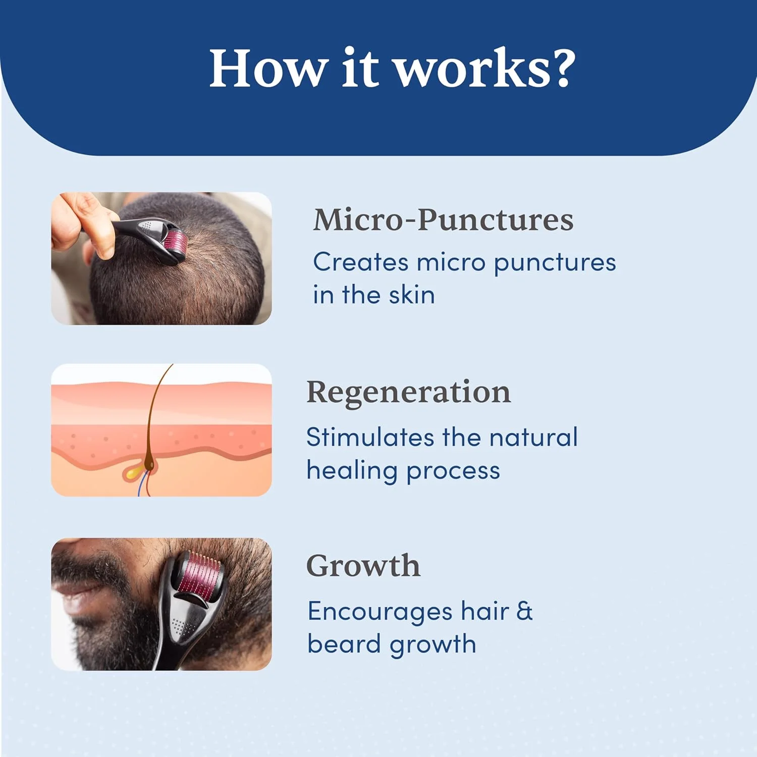 درمارولر مردانه با ضدعفونی کننده | 540 سوزن تیتانیومی آلیاژی 0.5 میلی متری | کاهش ریزش مو و تحریک فولیکول های مو | استفاده آسان | ایمن و موثر درمارولر مردانه با ضدعفونی کننده | 540 سوزن تیتانیومی آلیاژی 0.5 میلی متری | کاهش ریزش مو و تحریک فولیکول های مو | استفاده آسان | ایمن و موثر