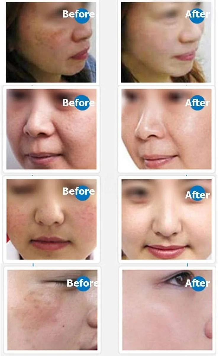 قلم درما دکتر.پن مدل ULTIMA - M5، سیستم میکرونیدلینگ خودکار، سیستم سوزن میکرو خودکار با طول سوزن قابل تنظیم، قلم درما استمپ، قابل تنظیم از 0.25 تا 2.5 میلی متر قلم درما دکتر.پن مدل ULTIMA - M5، سیستم میکرونیدلینگ خودکار، سیستم سوزن میکرو خودکار با طول سوزن قابل تنظیم، قلم درما استمپ، قابل تنظیم از 0.25 تا 2.5 میلی متر