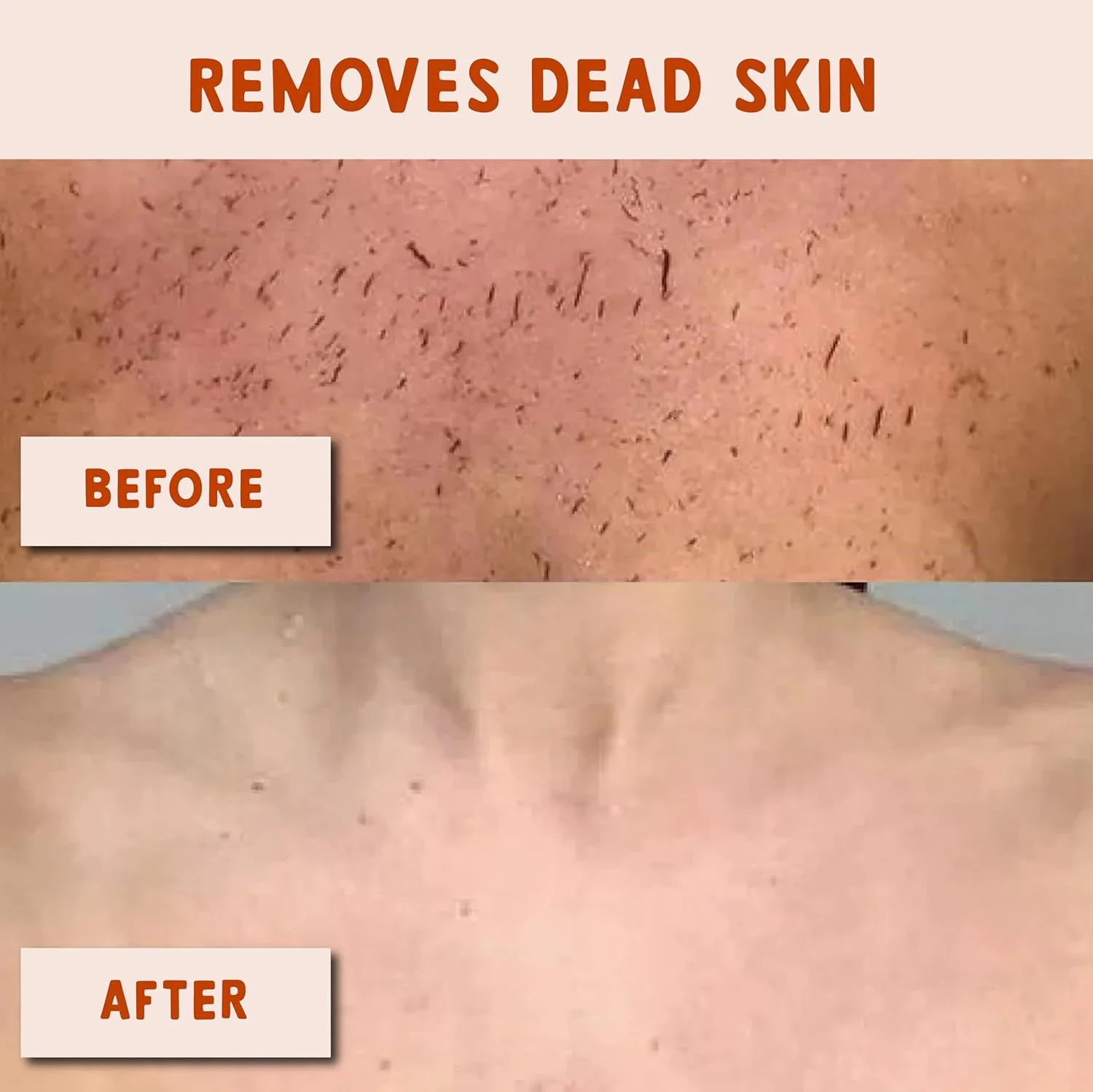 دستکش لایه بردار ابریشمی Deans 2 در 1 - ابریشم 100% ترکیه ای برای لایه برداری عمیق | اسکرابر بدن برای از بین بردن پوست مرده و کراتوز پیلاریس | دستکش ابریشمی برای پوست صاف دستکش لایه بردار ابریشمی Deans 2 در 1 - ابریشم 100% ترکیه ای برای لایه برداری عمیق | اسکرابر بدن برای از بین بردن پوست مرده و کراتوز پیلاریس | دستکش ابریشمی برای پوست صاف